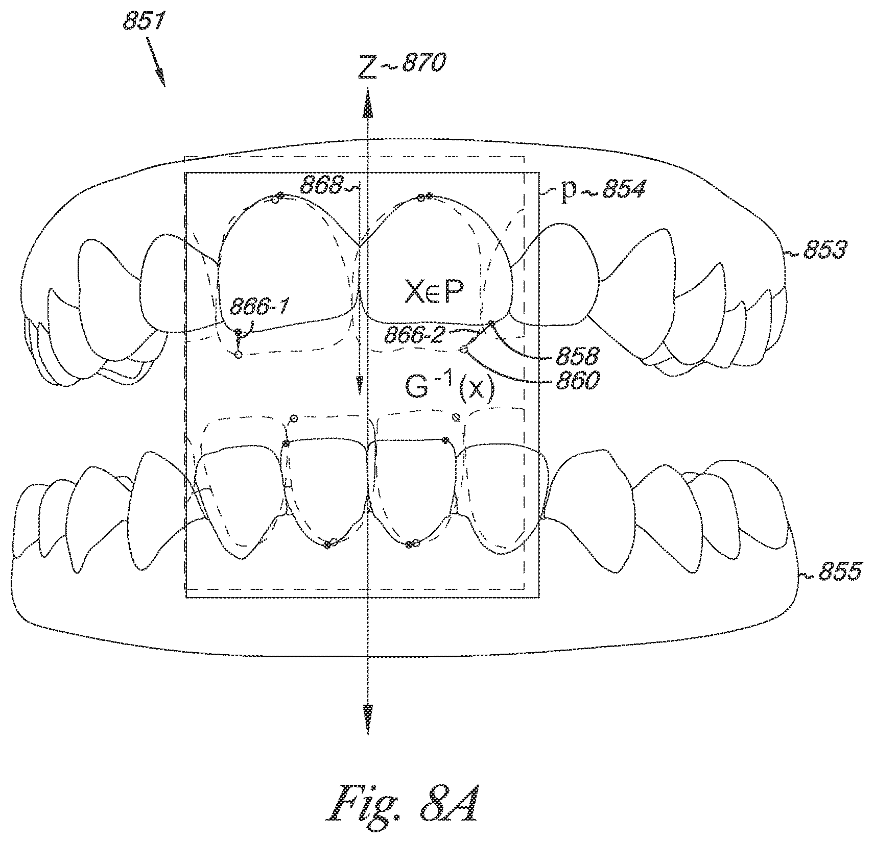 Patent US12324720 Figure 8 – Bite setting for dental treatment planning
