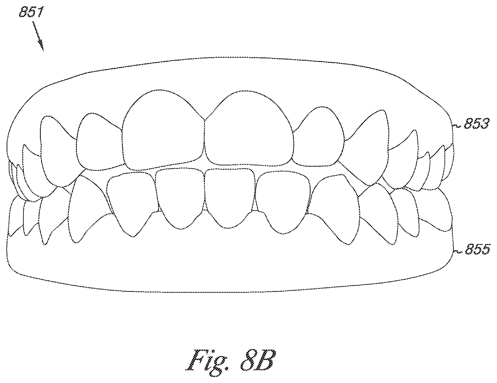 Patent US12324720 Figure 9 – Bite setting for dental treatment planning
