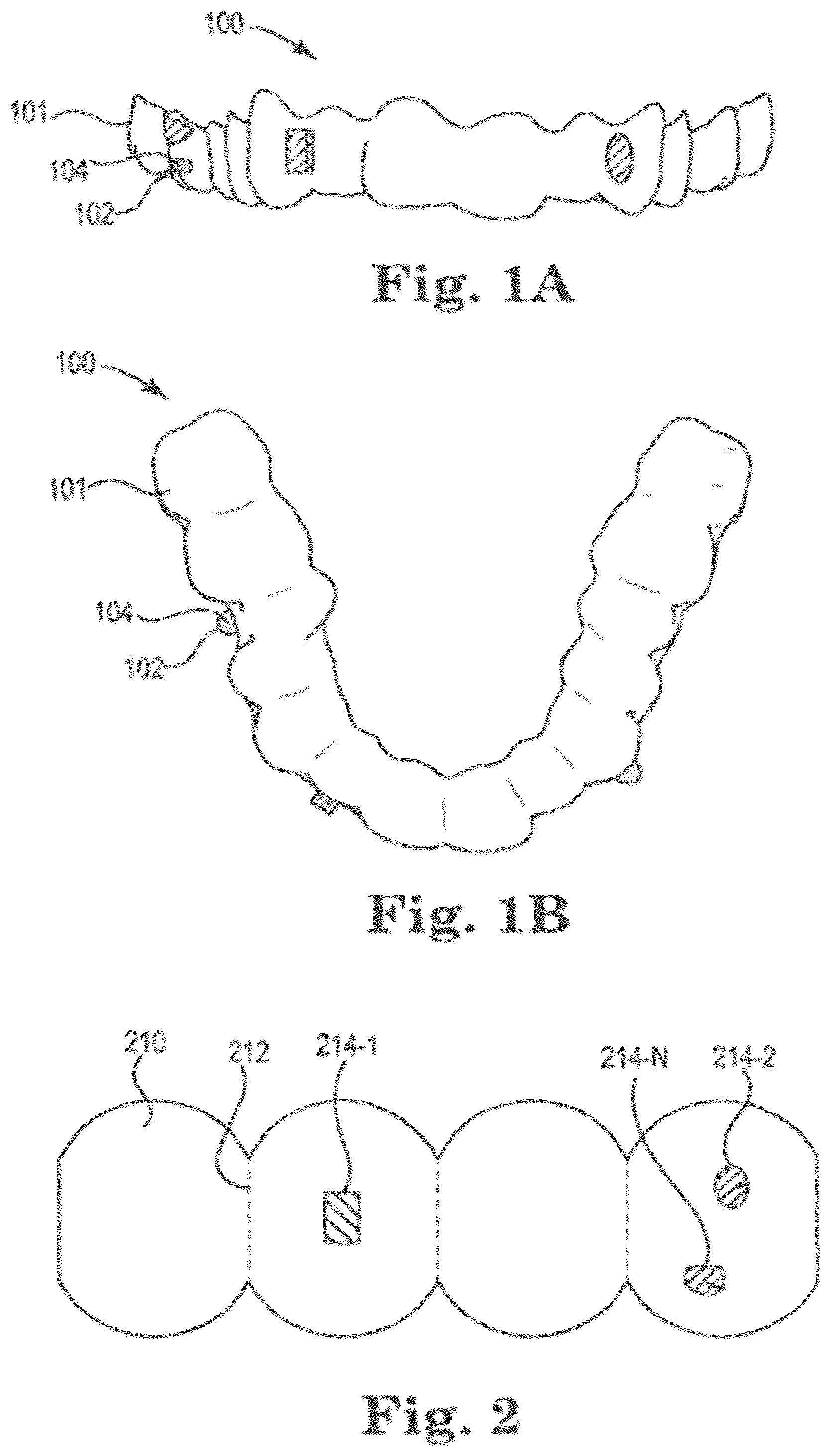 Patent US12324721 Figure 1 – Dental attachment positioning apparatuses