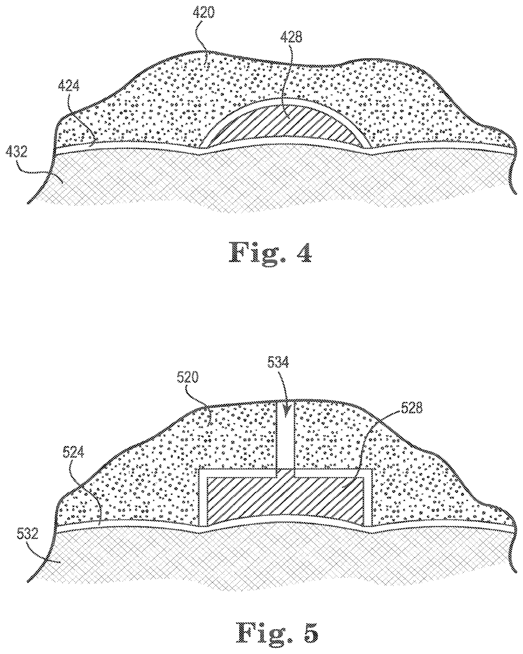 Patent US12324721 Figure 4 – Dental attachment positioning apparatuses