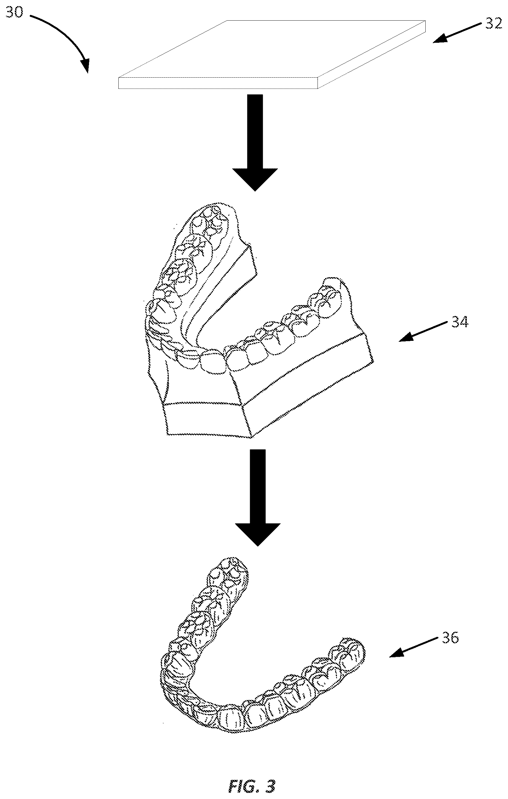 Patent US12324722 Figure 3 – Multilayer dental appliances and related methods and systems