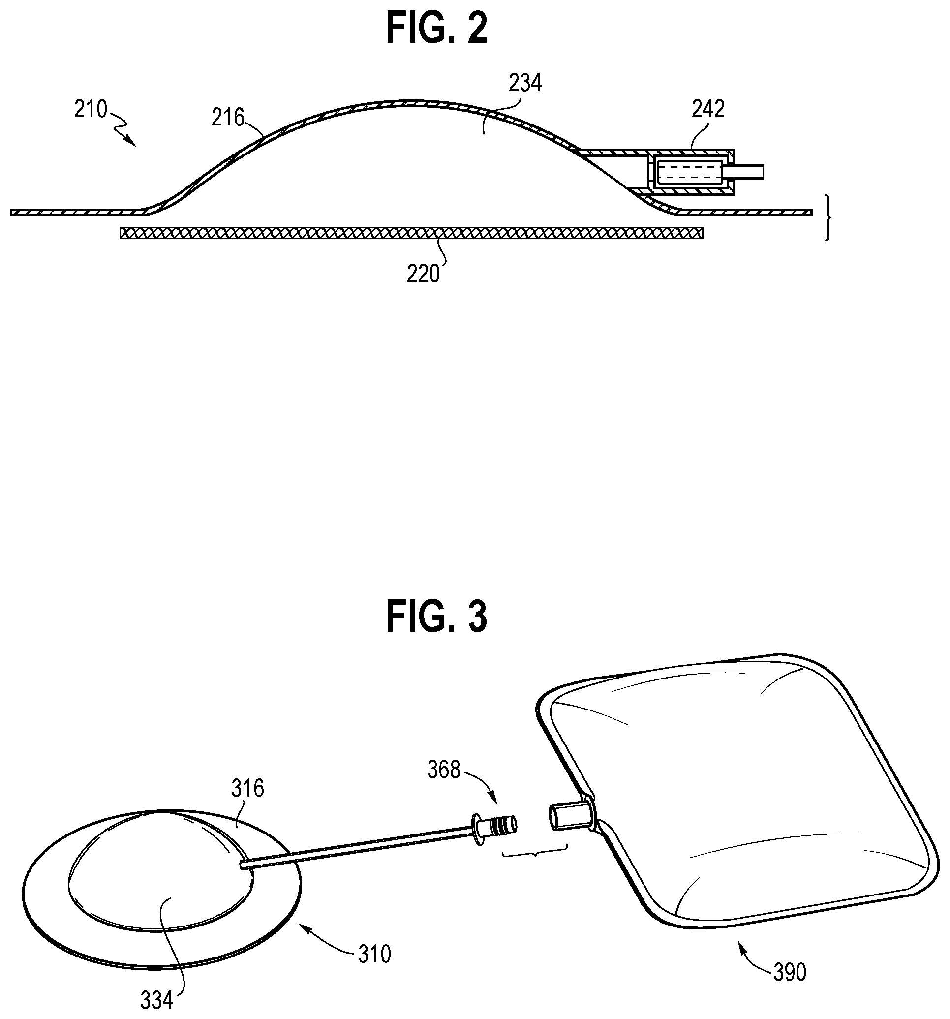 Patent US12324724 Figure 2 – Forward osmosis medical and wound care devices