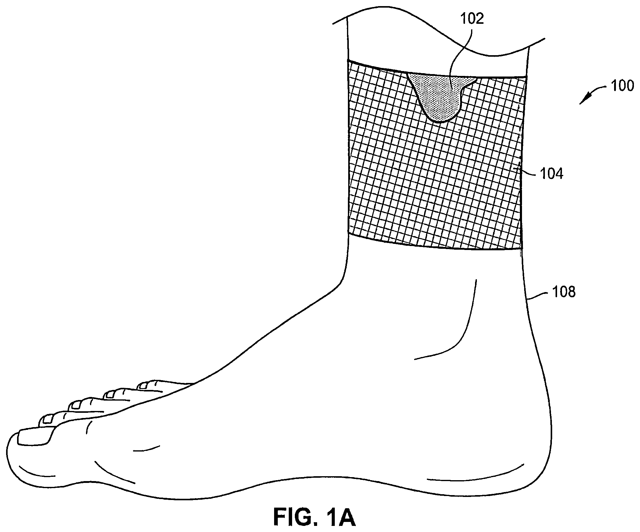 Patent US12324726 — Wound dressing garments, kits, systems, and methods — Figure 1
