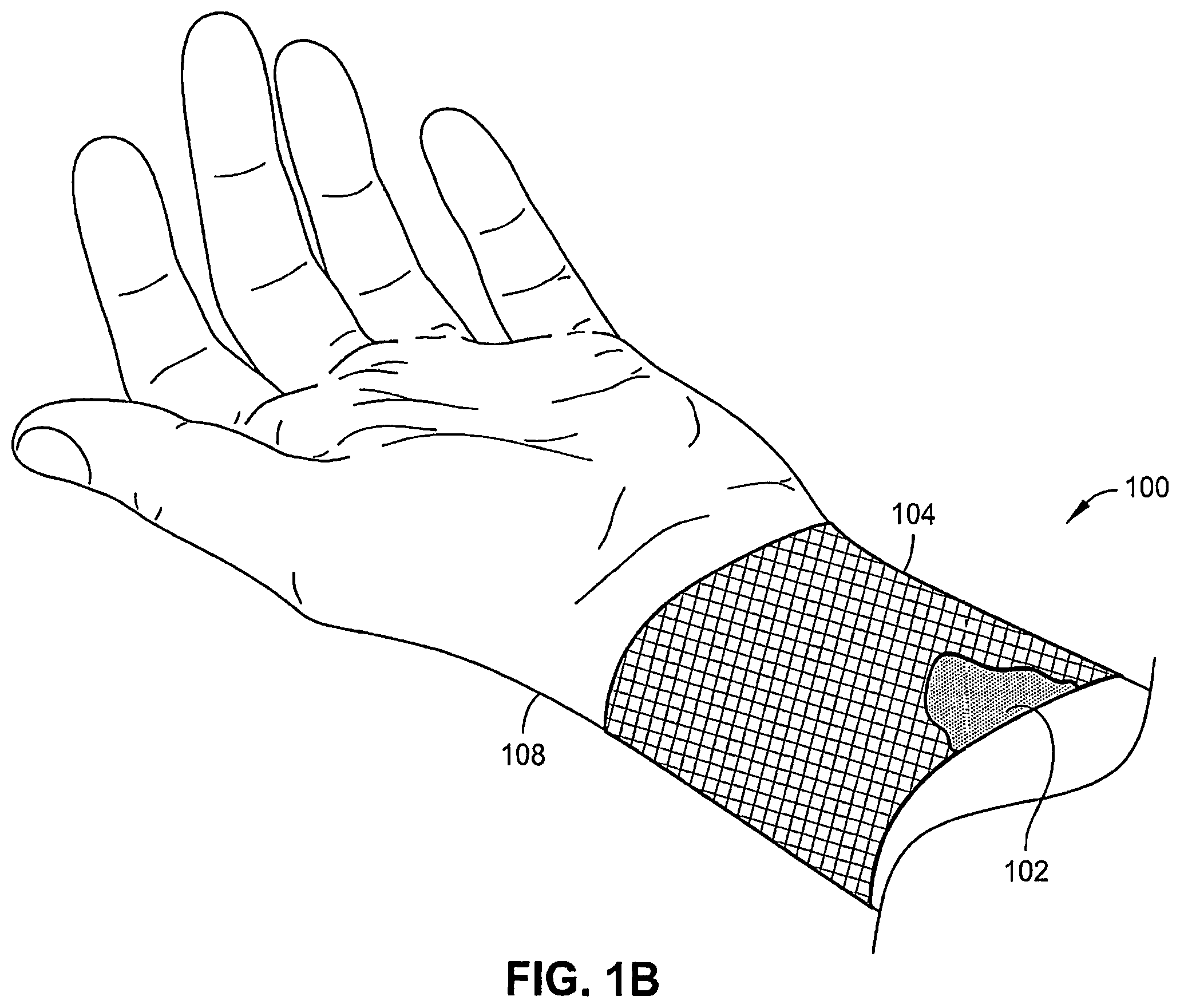 Patent US12324726 Figure 2 – Wound dressing garments, kits, systems, and methods