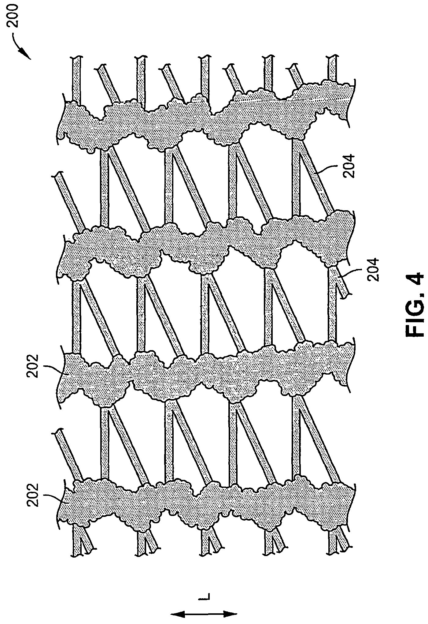 Patent US12324726 Figure 5 – Wound dressing garments, kits, systems, and methods