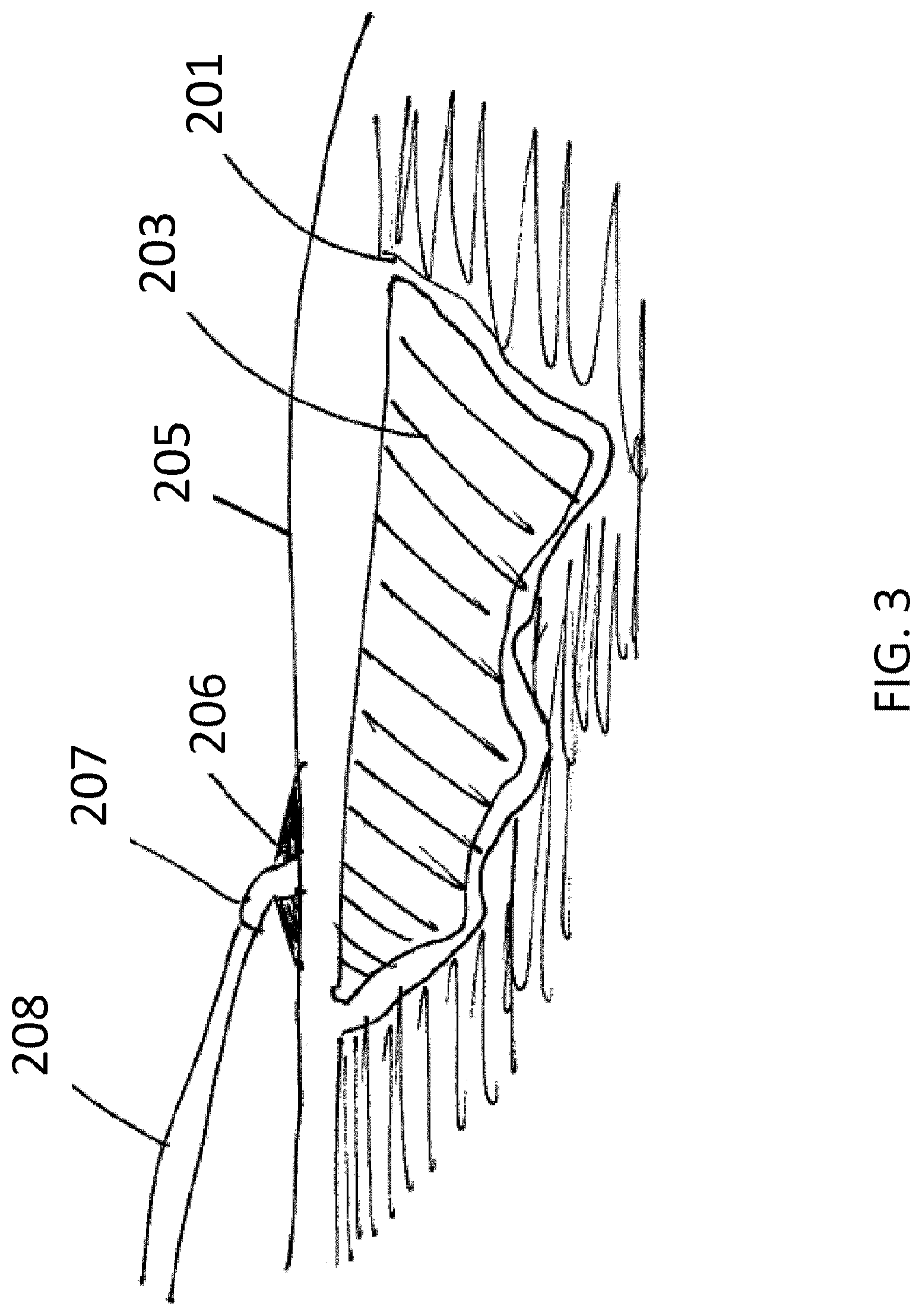 Patent US12324727 Figure 3 – Wound treatment apparatuses