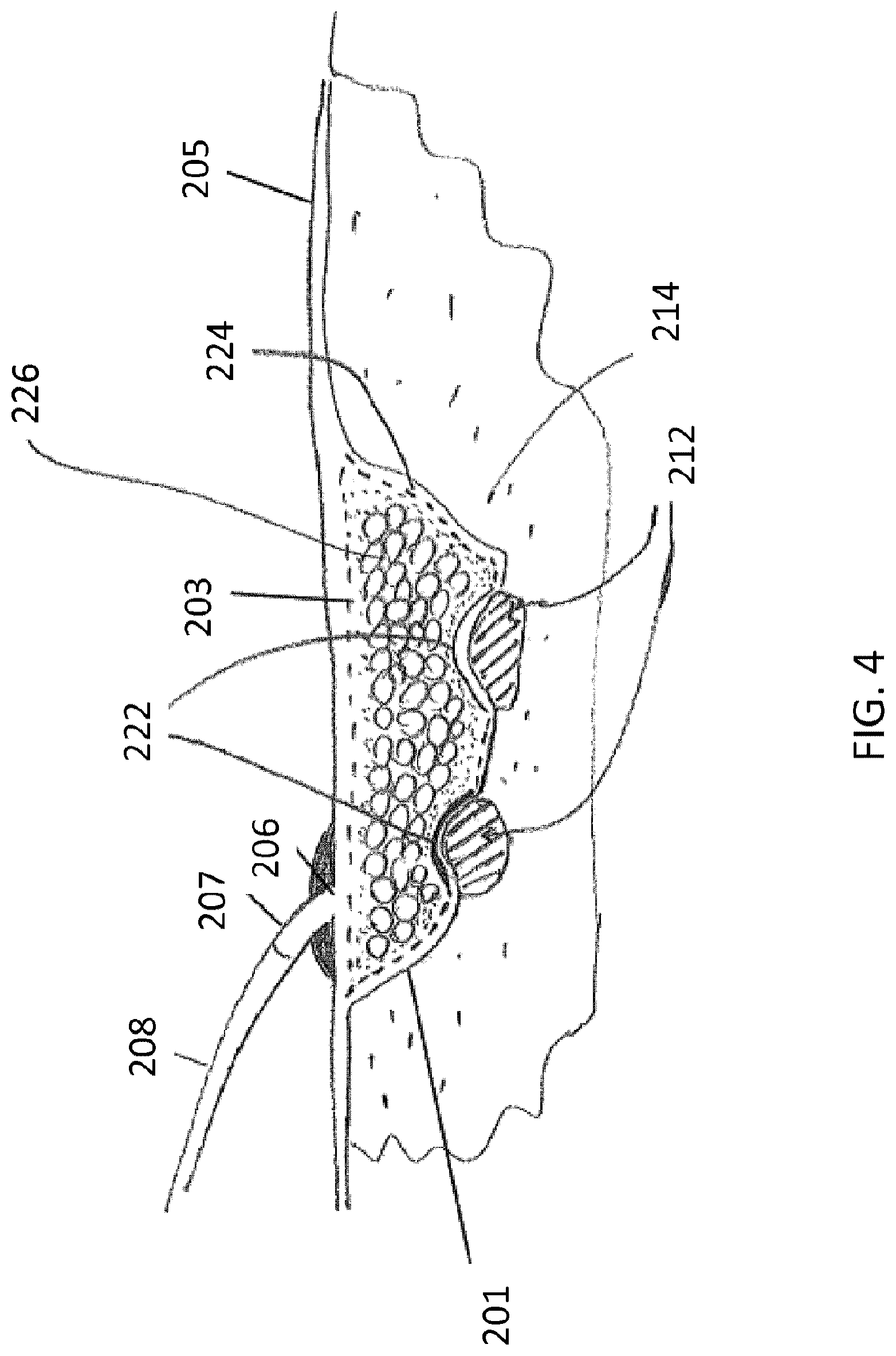 Patent US12324727 Figure 4 – Wound treatment apparatuses