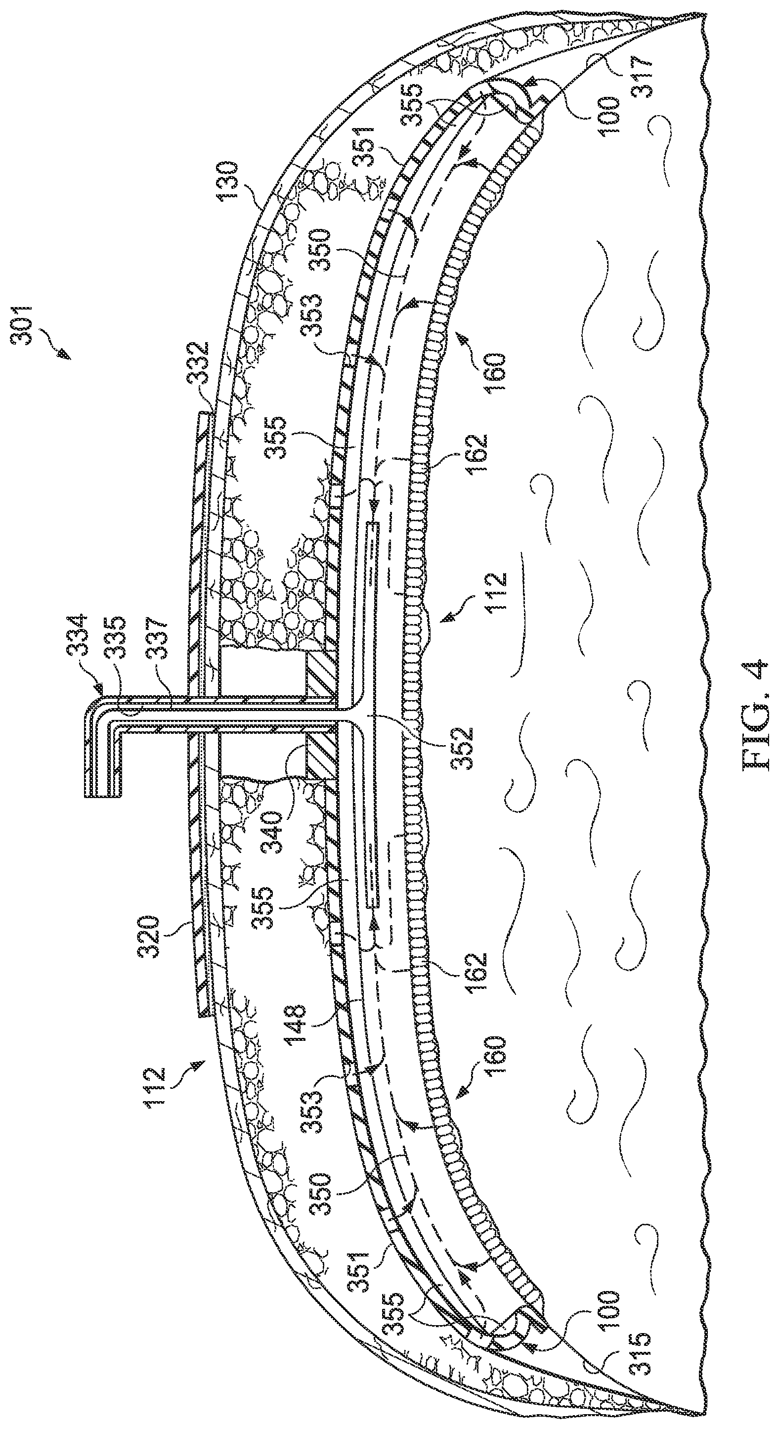 Patent US12324728 Figure 5 – Manifolding apparatus or dressing exhibiting low tissue ingrowth and negative-pressure treatment method