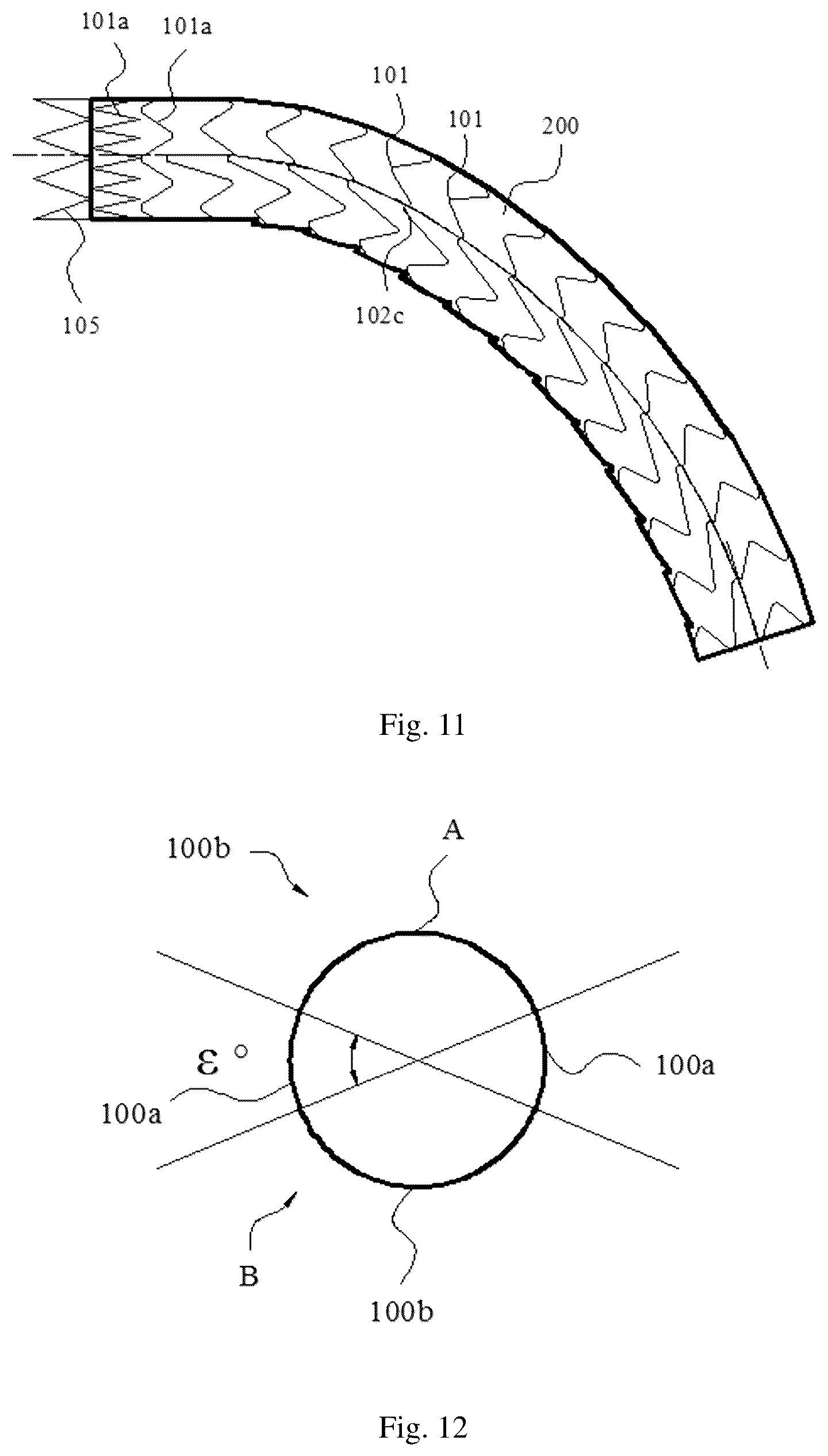 Patent US12324735 Figure 6 – Stent graft with variable coverage of wavy rings