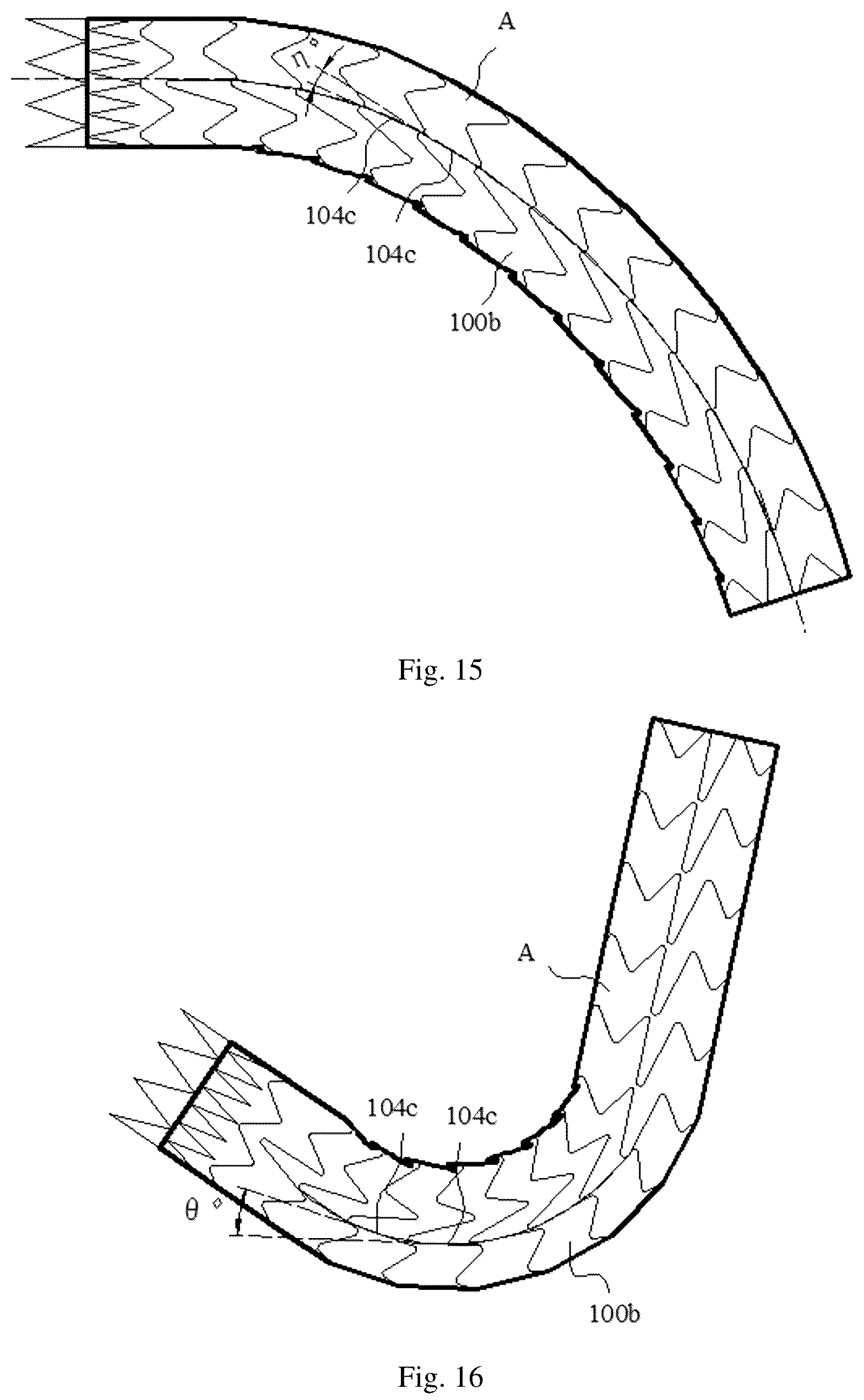 Patent US12324735 Figure 8 – Stent graft with variable coverage of wavy rings