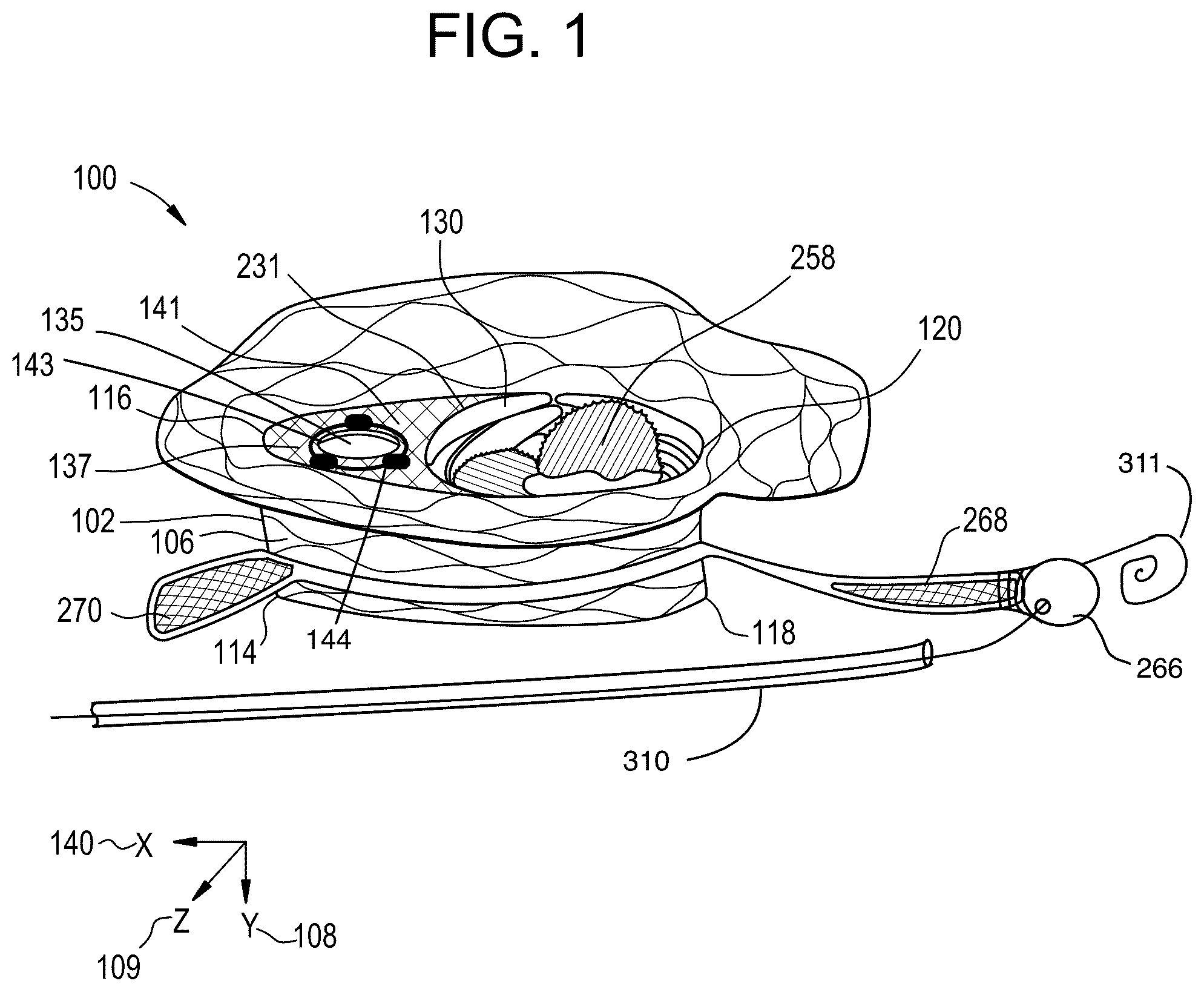 Patent US12324737 Figure 1 – Tricuspid regurgitation control devices for orthogonal transcatheter heart valve prosthesis
