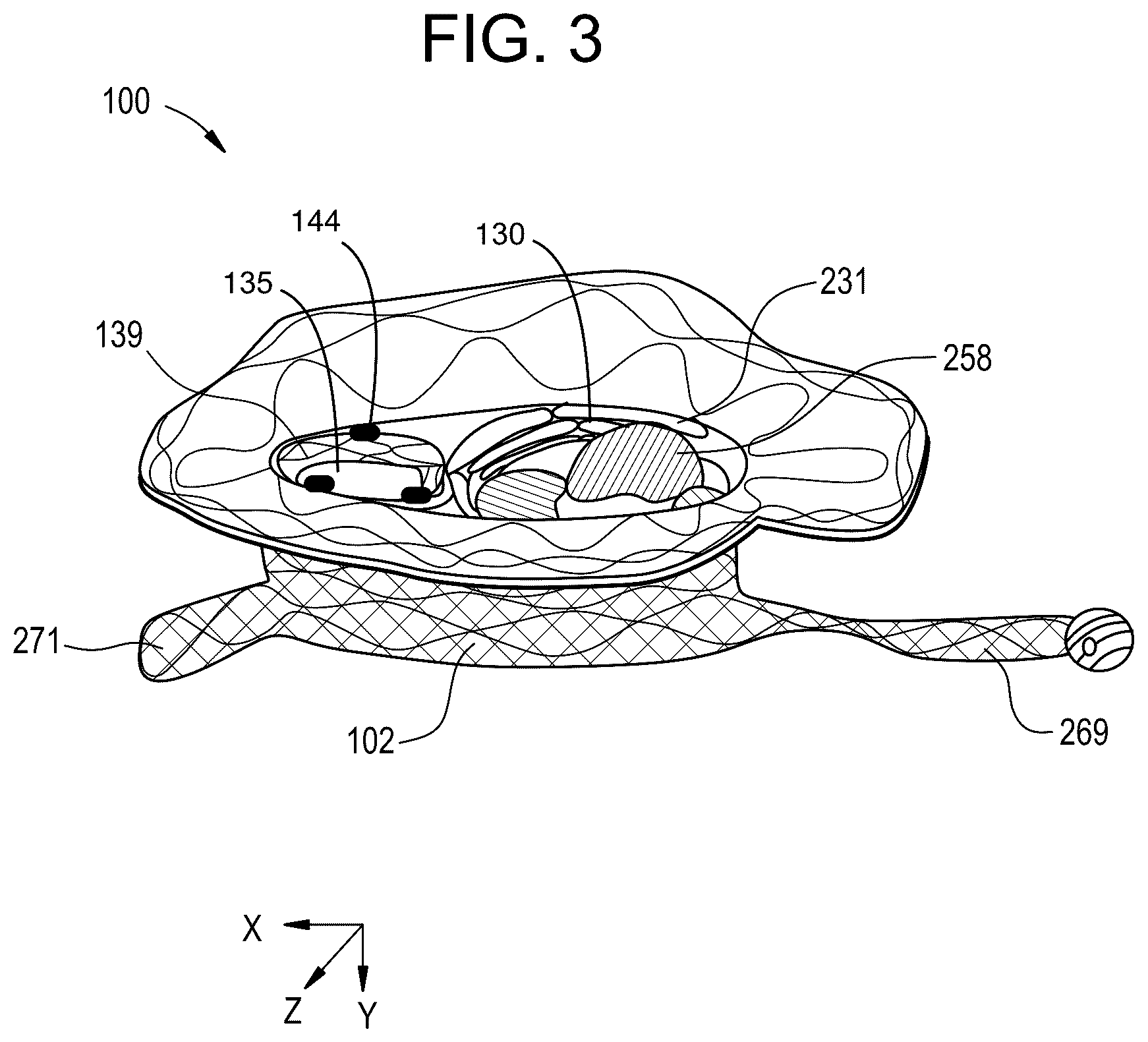 Patent US12324737 Figure 3 – Tricuspid regurgitation control devices for orthogonal transcatheter heart valve prosthesis