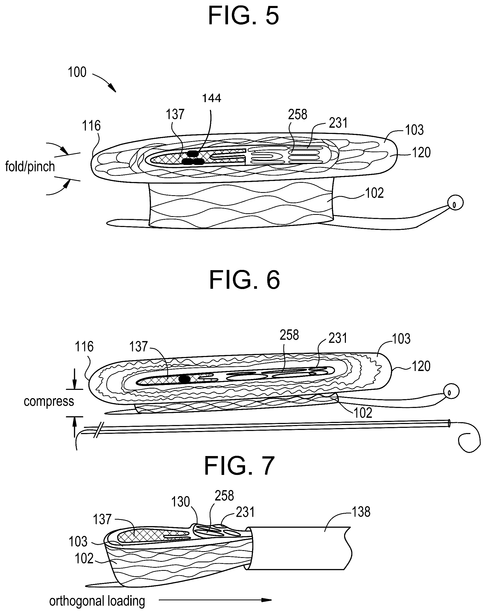 Patent US12324737 Figure 5 – Tricuspid regurgitation control devices for orthogonal transcatheter heart valve prosthesis