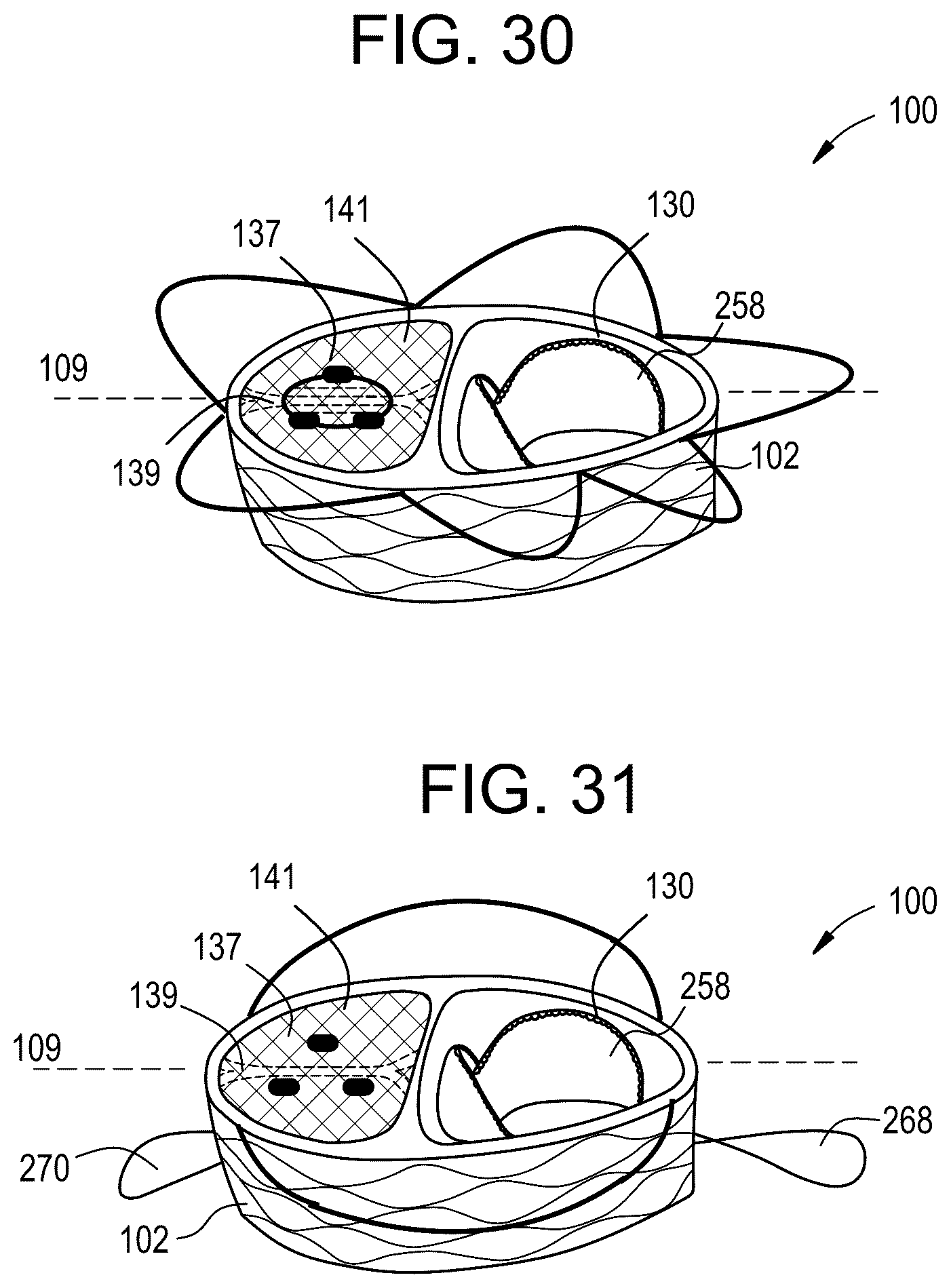 Patent US12324737 Figure 13 – Tricuspid regurgitation control devices for orthogonal transcatheter heart valve prosthesis