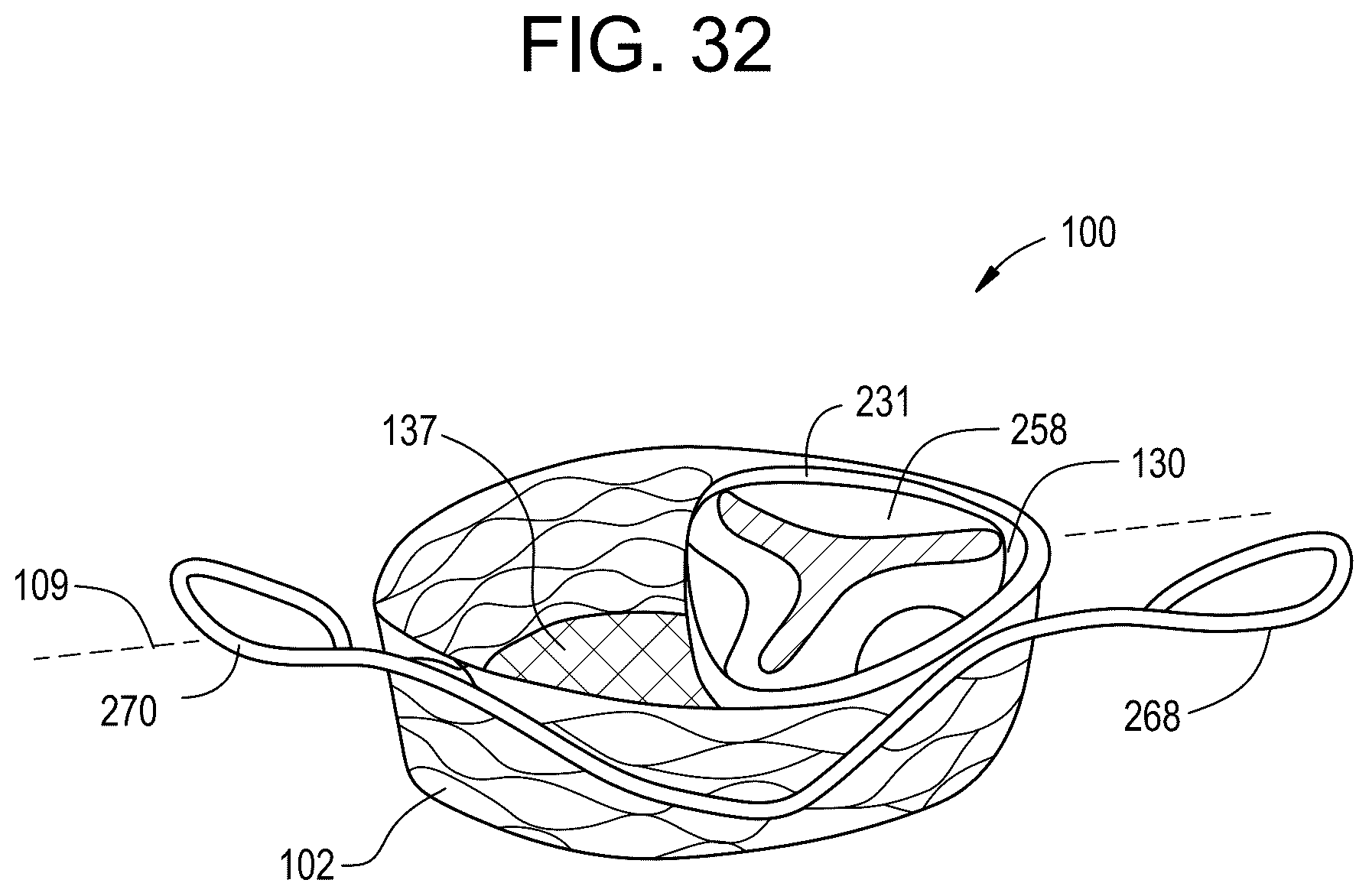 Patent US12324737 Figure 14 – Tricuspid regurgitation control devices for orthogonal transcatheter heart valve prosthesis