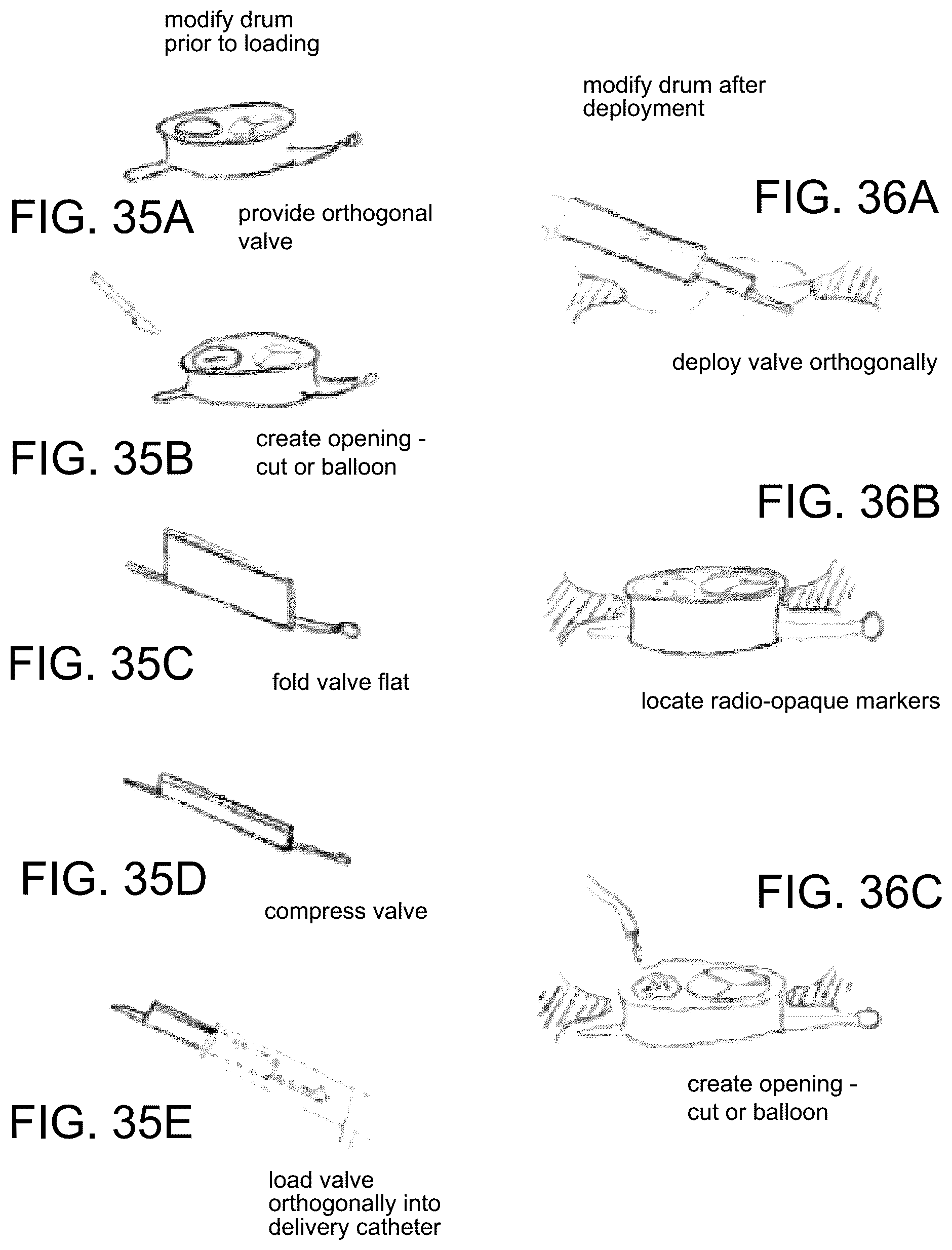Patent US12324737 Figure 16 – Tricuspid regurgitation control devices for orthogonal transcatheter heart valve prosthesis