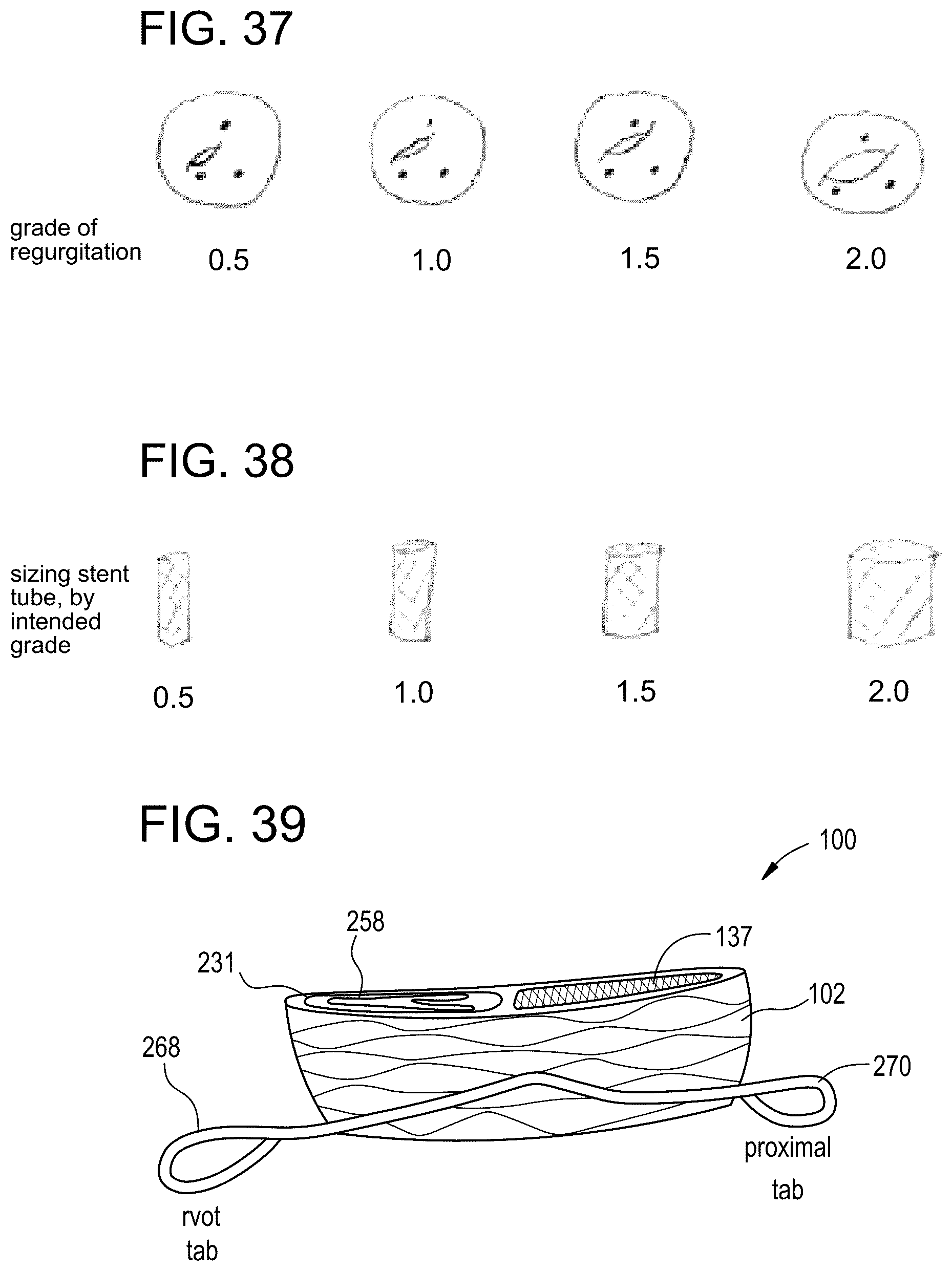Patent US12324737 Figure 17 – Tricuspid regurgitation control devices for orthogonal transcatheter heart valve prosthesis