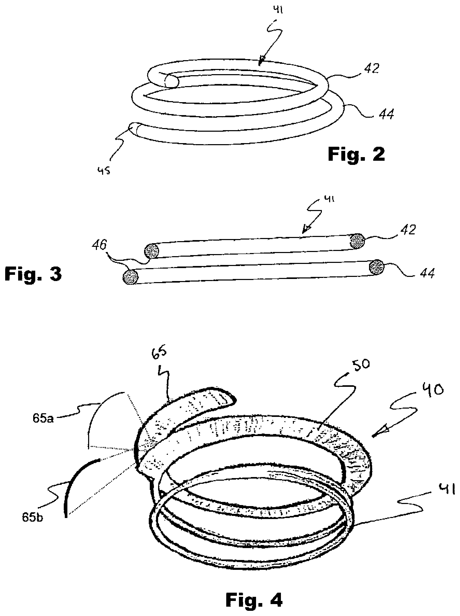 Patent US12324740 Figure 3 – Device and method for improving function of heart valve