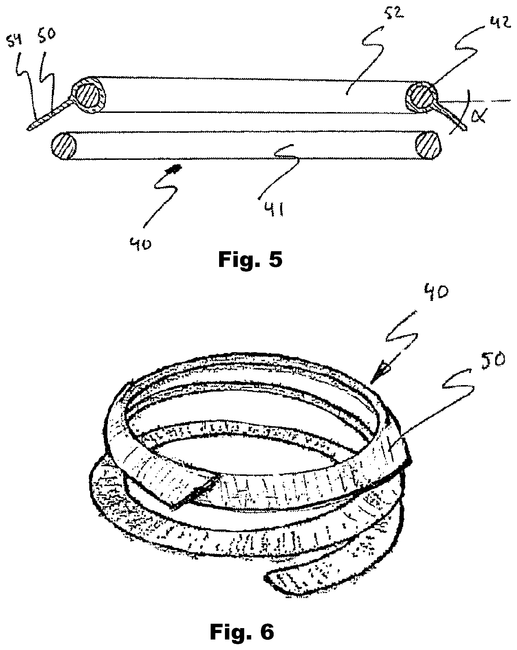 Patent US12324740 Figure 4 – Device and method for improving function of heart valve