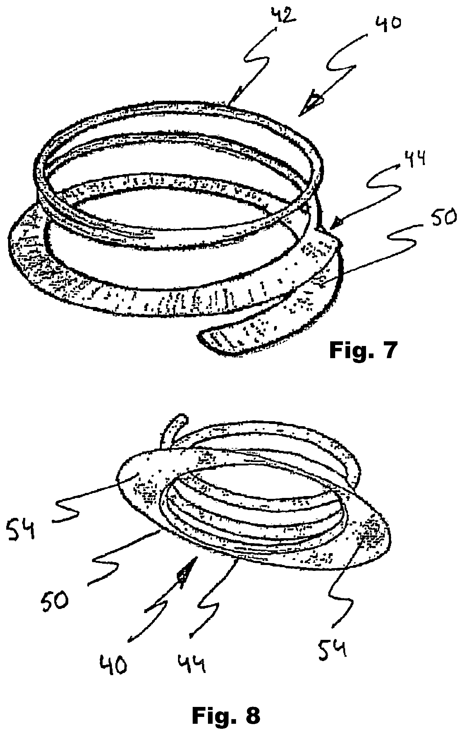 Patent US12324740 Figure 5 – Device and method for improving function of heart valve