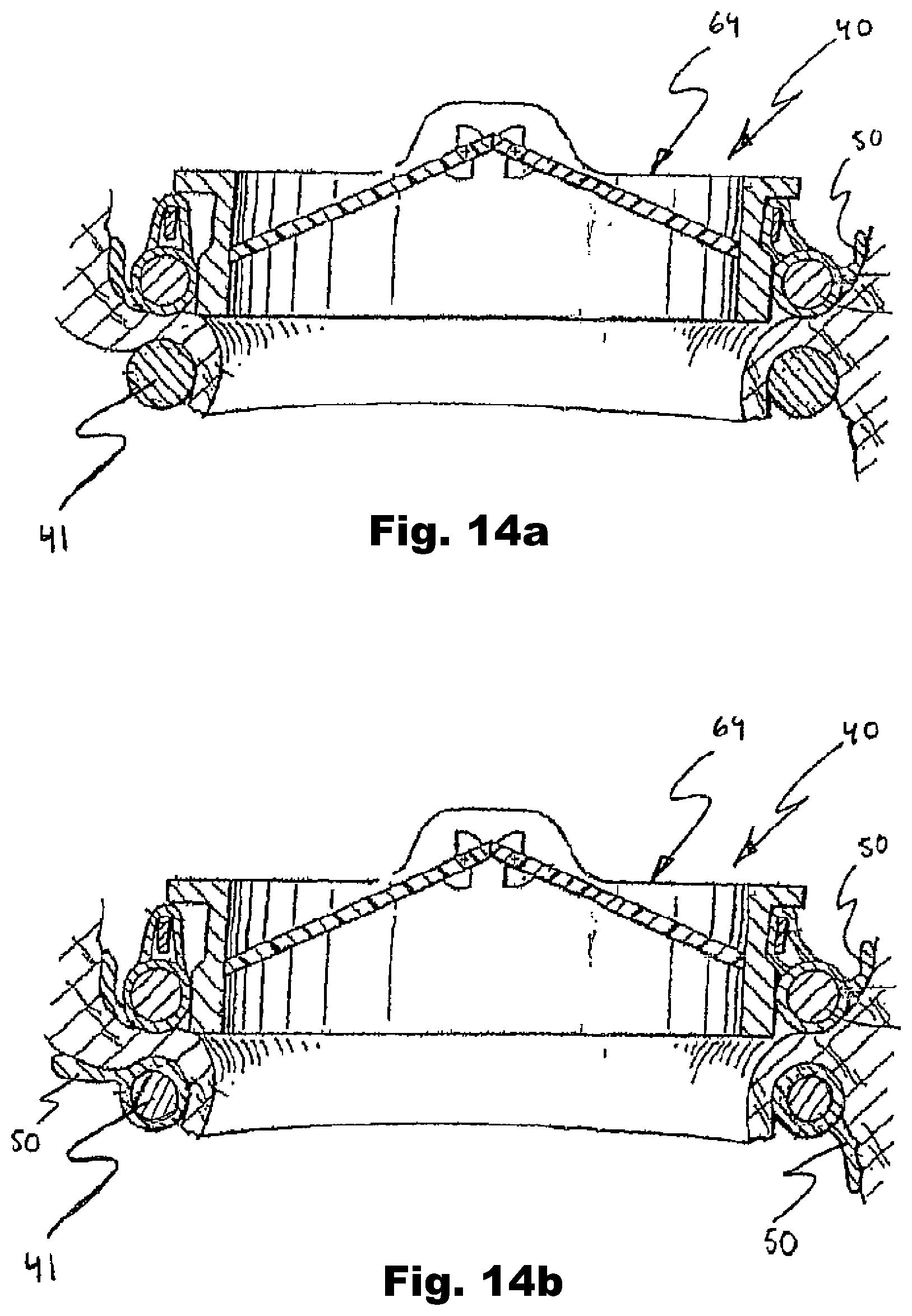 Patent US12324740 Figure 9 – Device and method for improving function of heart valve