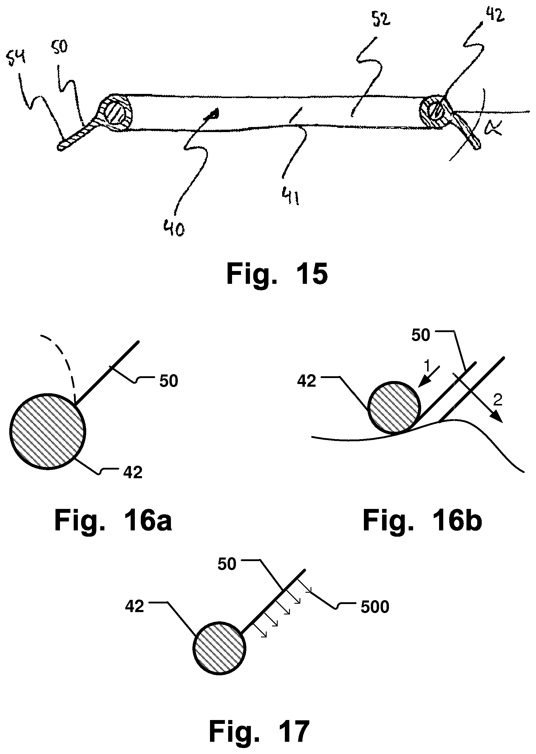Patent US12324740 Figure 10 – Device and method for improving function of heart valve