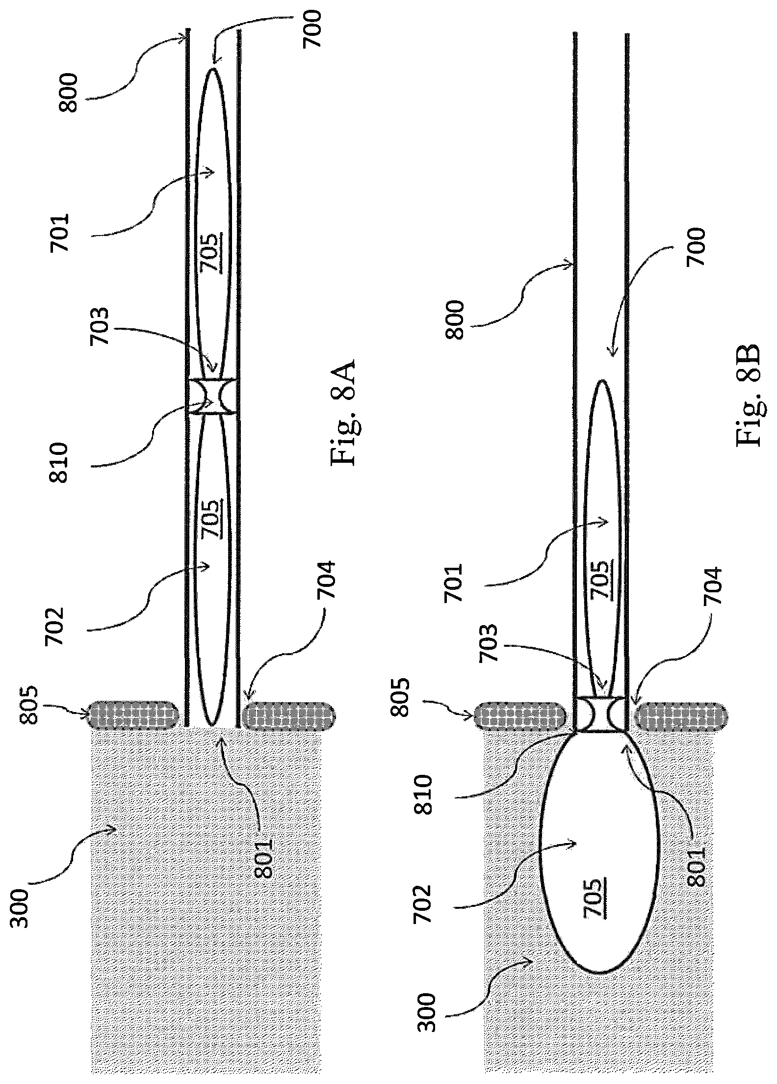 Patent US12324741 Figure 8 – Medical chamber system, introduction system and kit