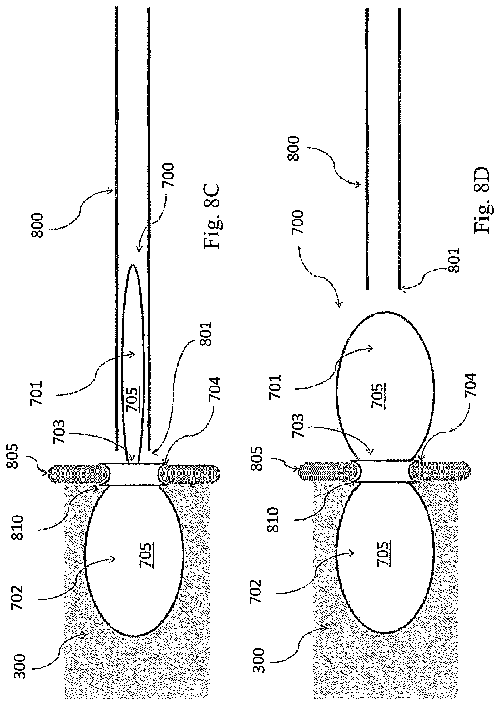 Patent US12324741 Figure 9 – Medical chamber system, introduction system and kit