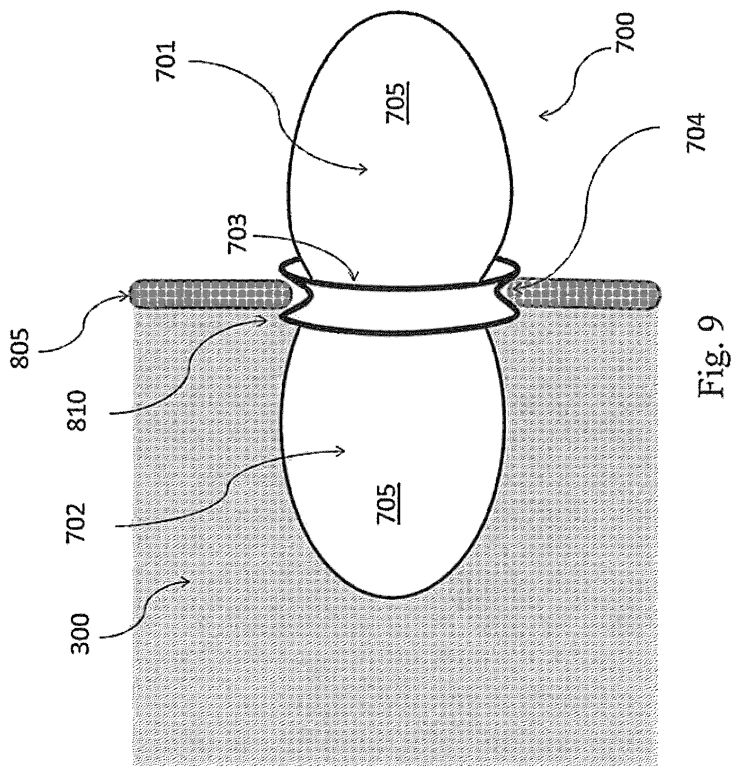 Patent US12324741 Figure 10 – Medical chamber system, introduction system and kit