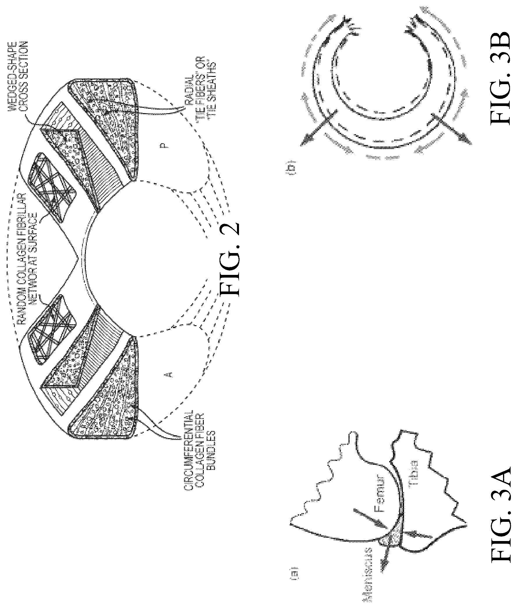 Patent US12324742 Figure 2 – Orthopedic implants having circumferential and non-circumferential fibers