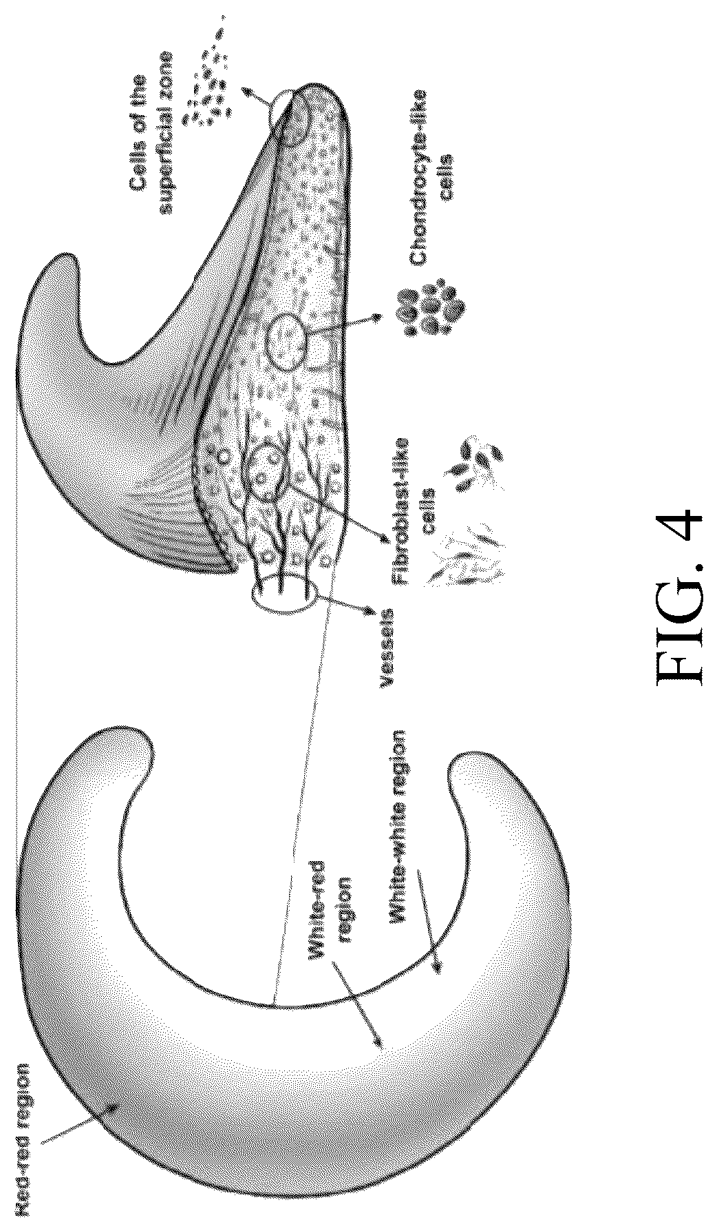 Patent US12324742 Figure 3 – Orthopedic implants having circumferential and non-circumferential fibers