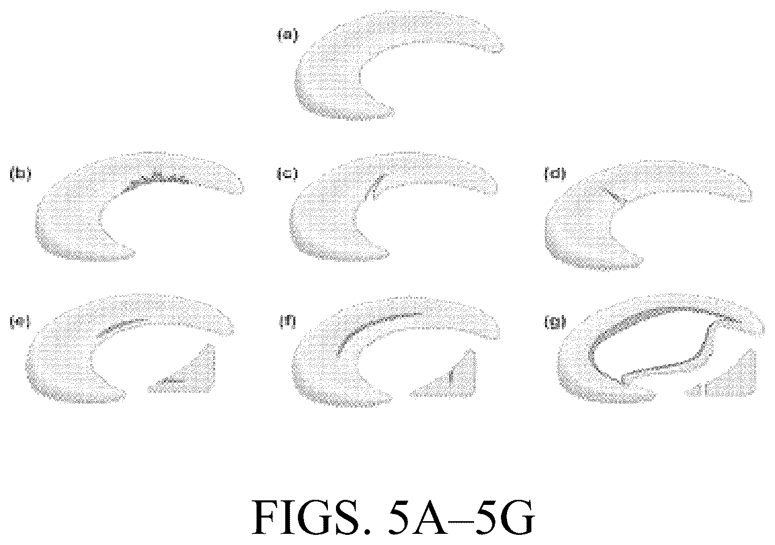 Patent US12324742 Figure 4 – Orthopedic implants having circumferential and non-circumferential fibers