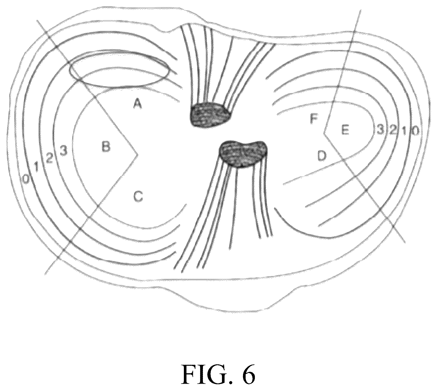Patent US12324742 Figure 5 – Orthopedic implants having circumferential and non-circumferential fibers