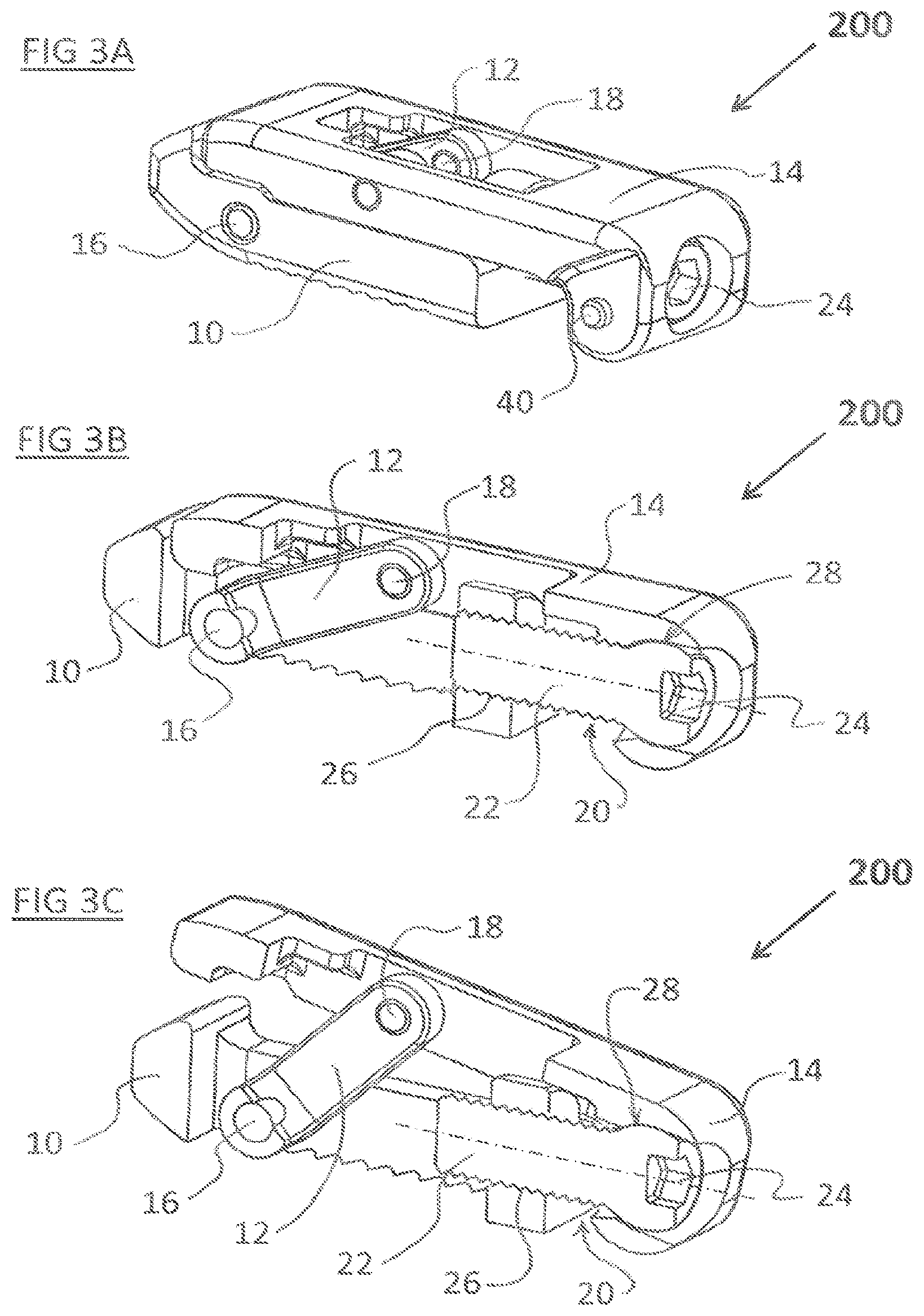 Patent US12324744 Figure 3 – Expandable implant with deflectable sequence of segments