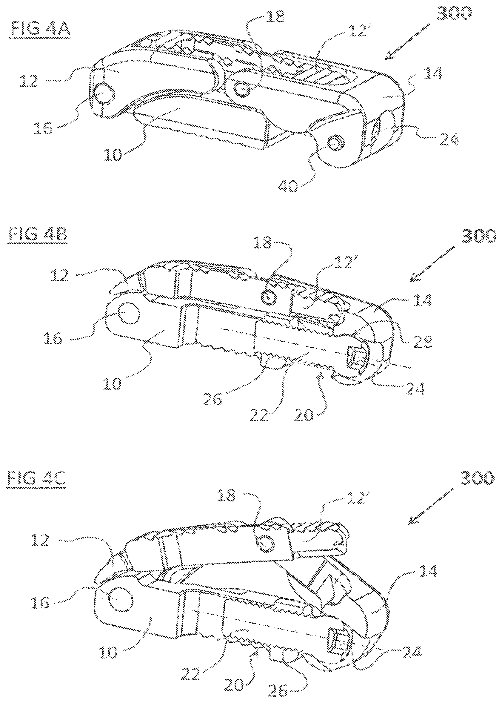 Patent US12324744 Figure 4 – Expandable implant with deflectable sequence of segments