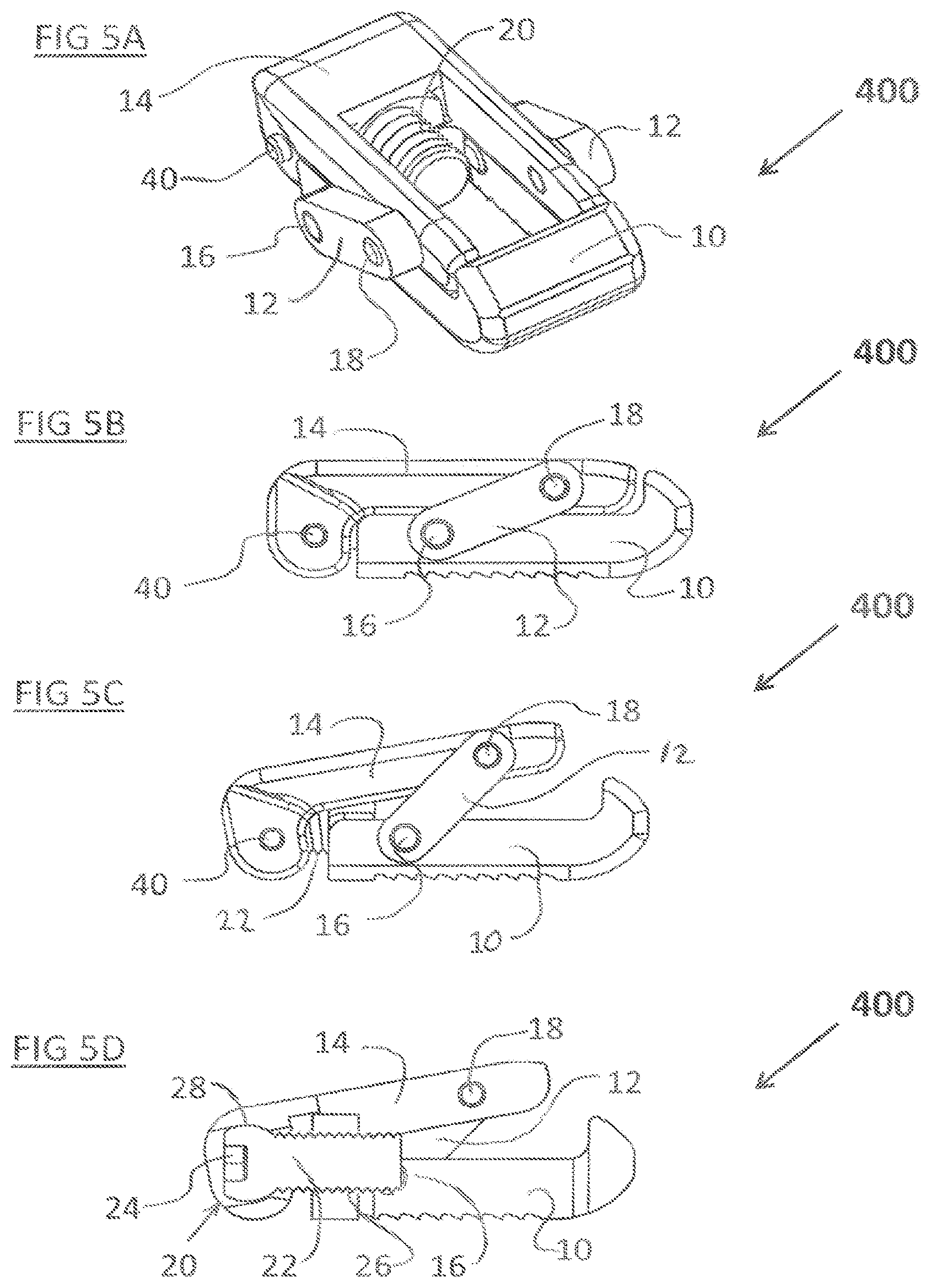 Patent US12324744 Figure 5 – Expandable implant with deflectable sequence of segments