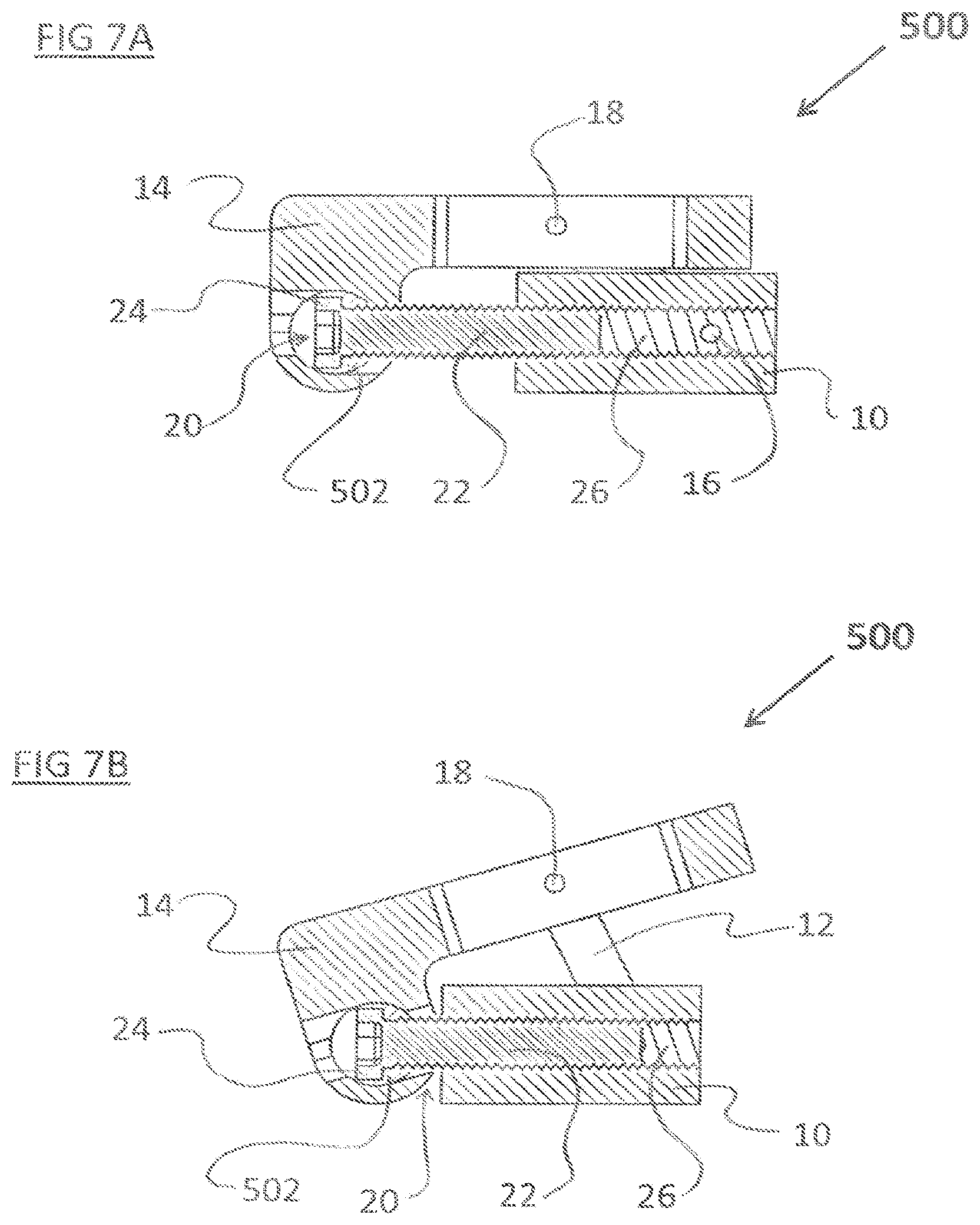 Patent US12324744 Figure 7 – Expandable implant with deflectable sequence of segments