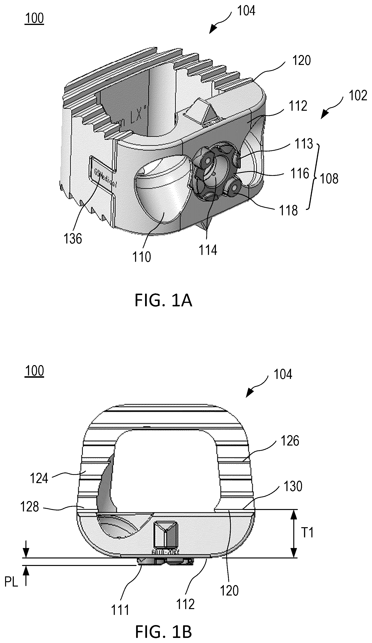 Patent US12324746 Figure 1 – Implant, system including implant, and method of using system