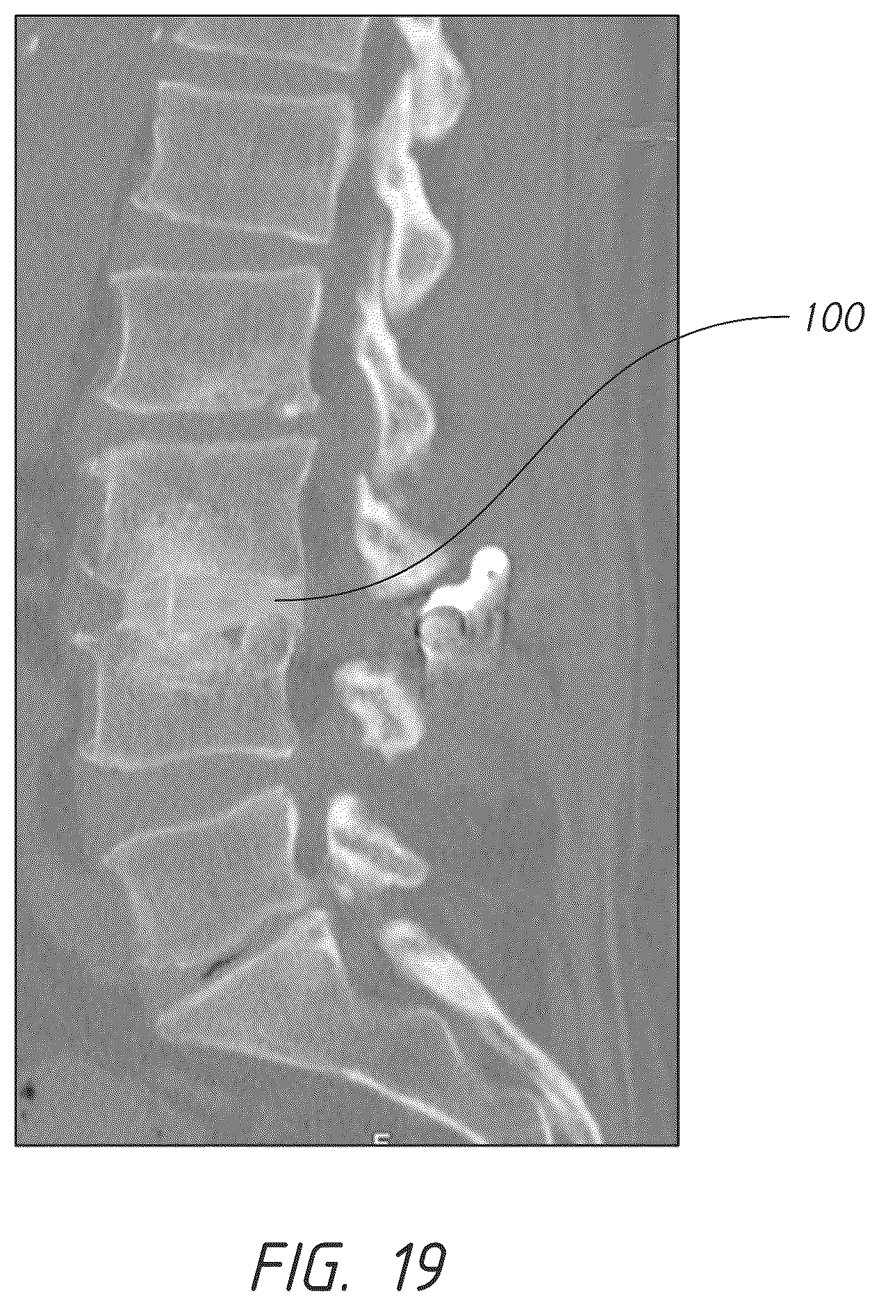 Patent US12324747 Figure 19 – Side pocket spinal fusion cage