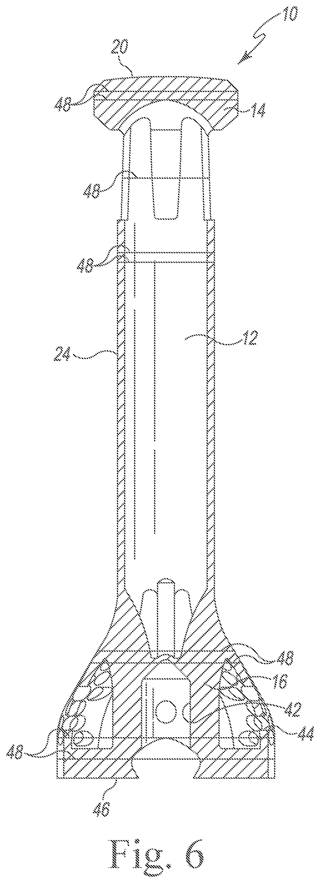 Patent US12324749 Figure 5 – Impaction handle for implanting a tibial tray of an orthopaedic knee prosthesis and associated method of making the same