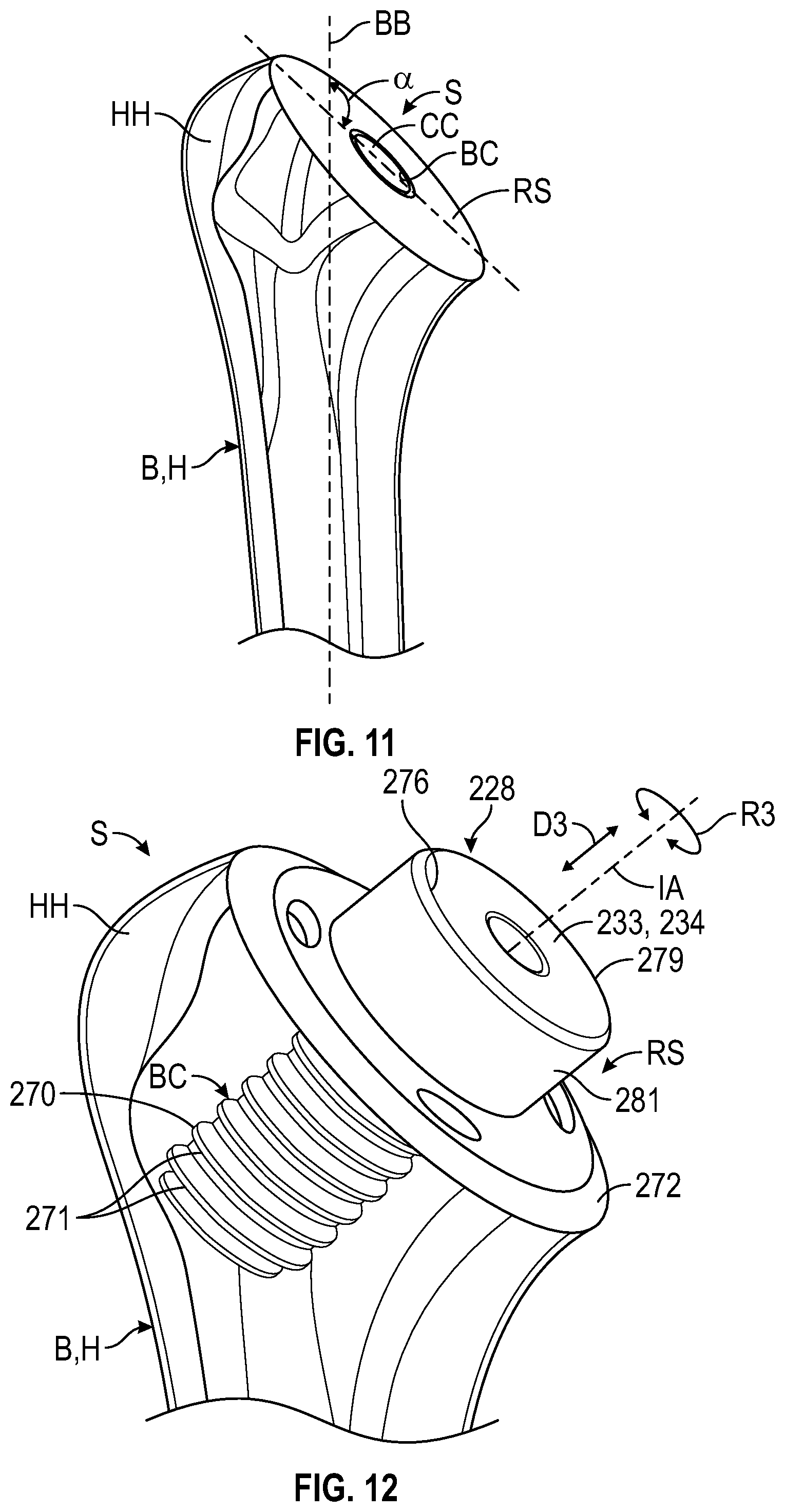 Patent US12324750 Figure 10 – Shield guide assembly
