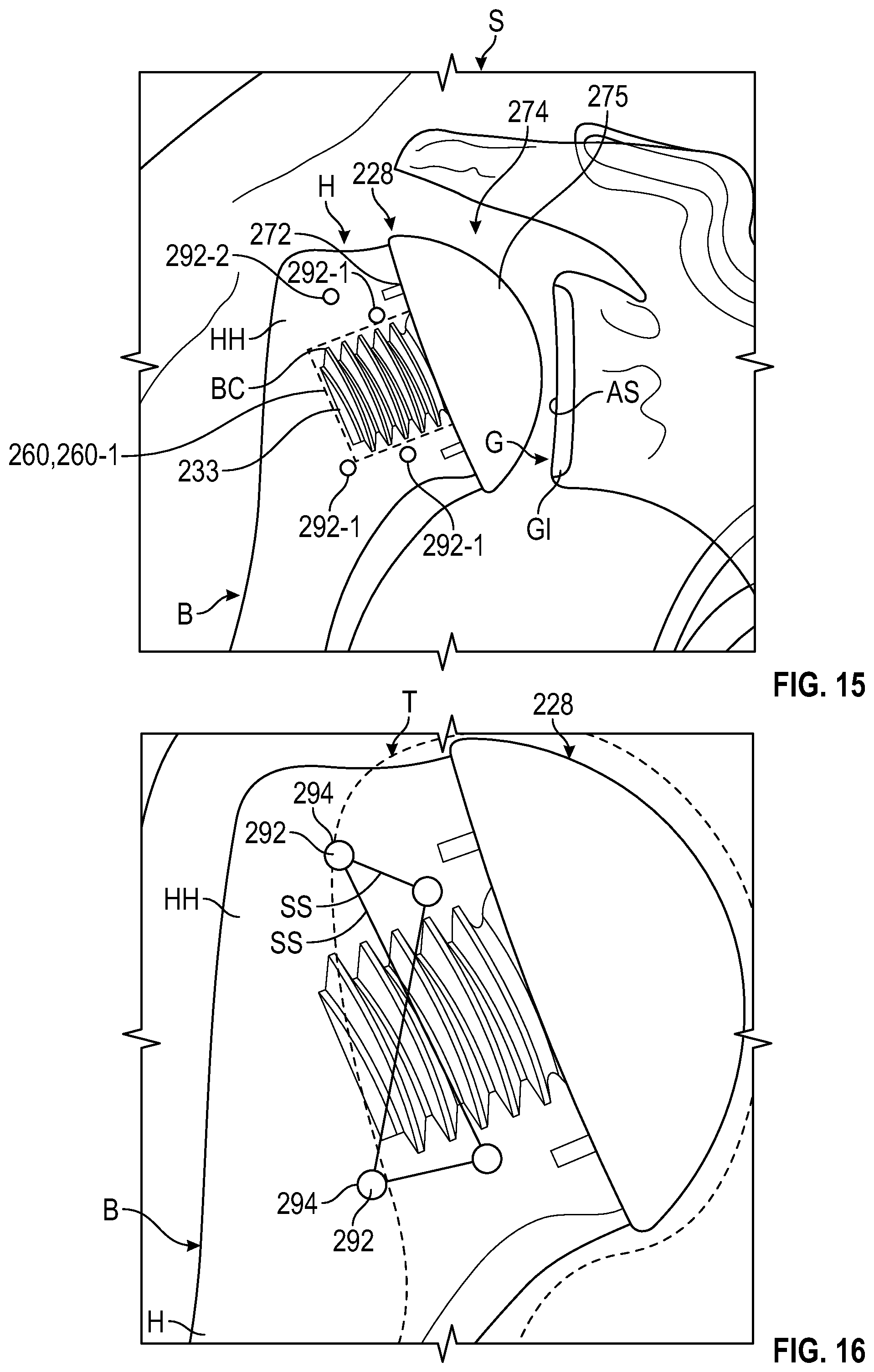 Patent US12324750 Figure 13 – Shield guide assembly