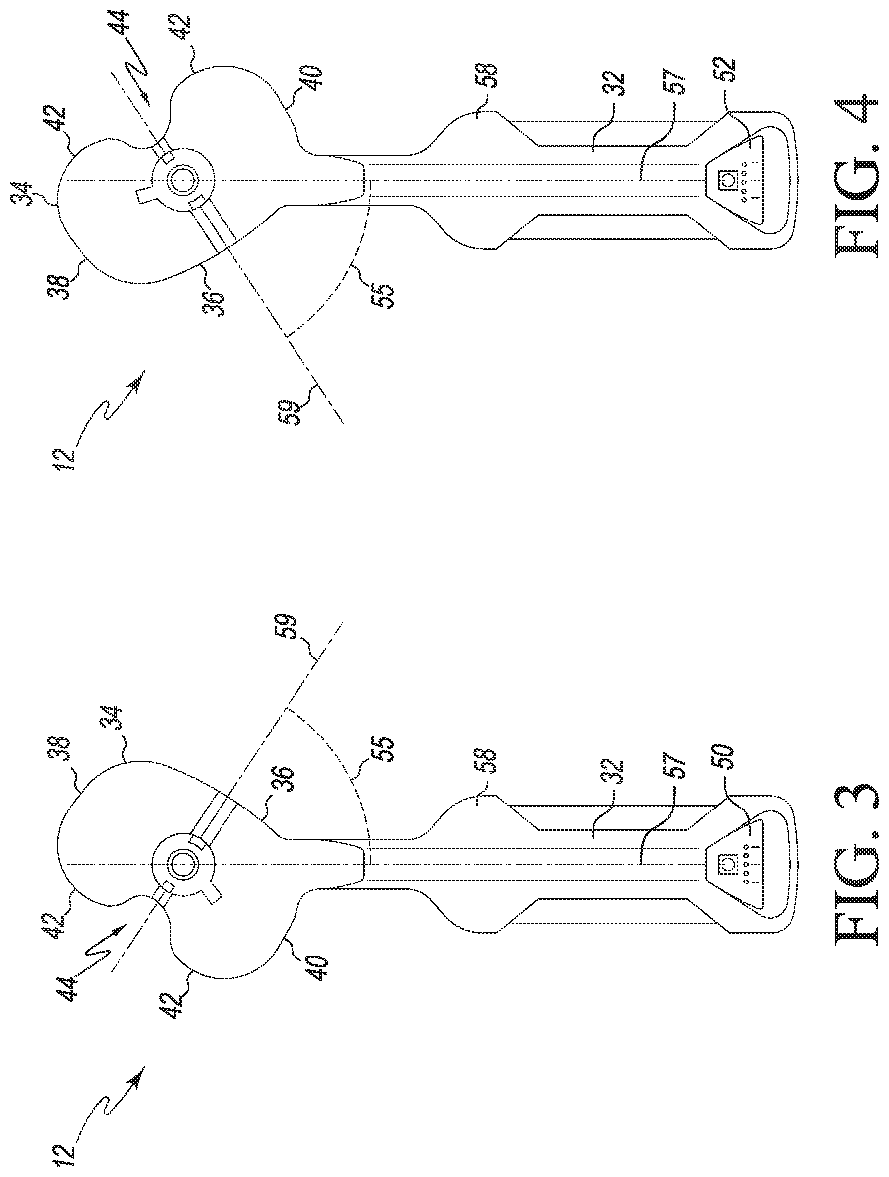 Patent US12324752 Figure 3 – Orthopaedic surgical system for determining joint forces of a patient's knee joint