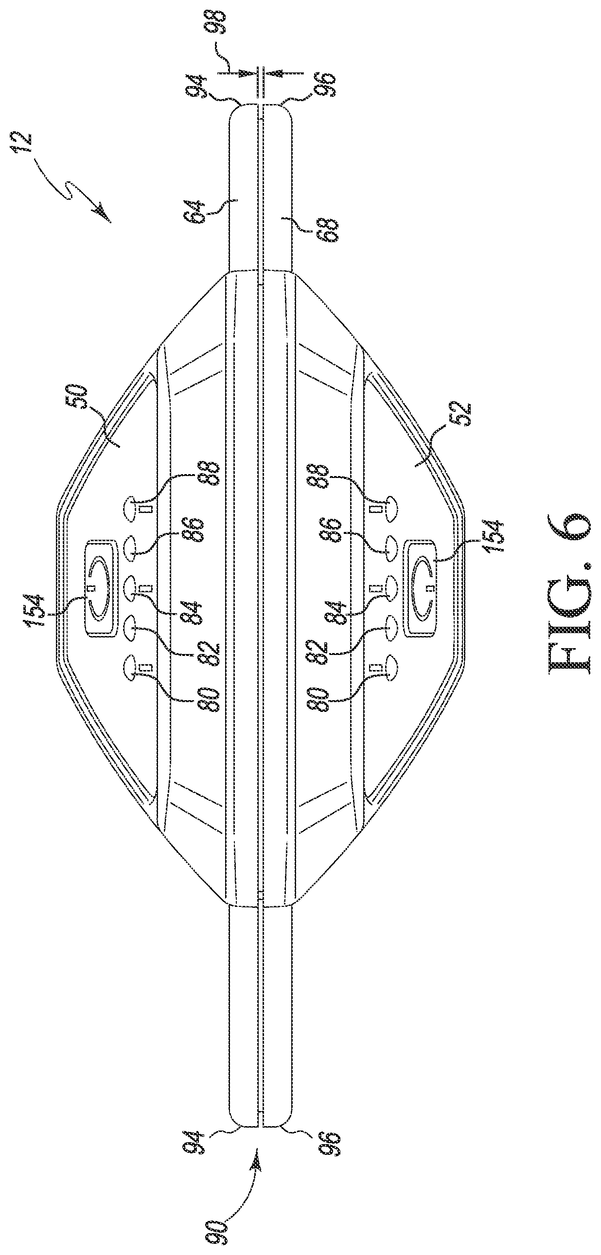 Patent US12324752 Figure 5 – Orthopaedic surgical system for determining joint forces of a patient's knee joint