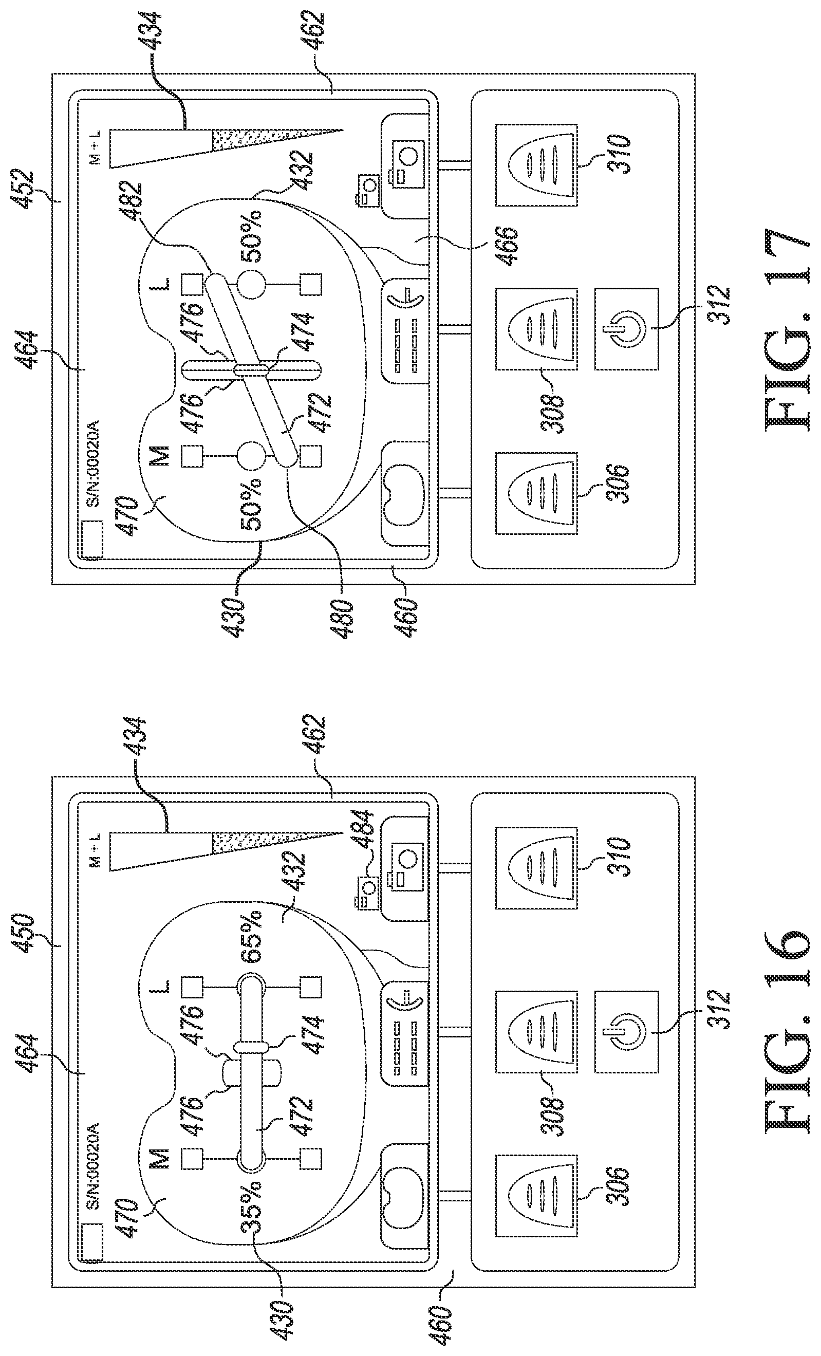 Patent US12324752 Figure 15 – Orthopaedic surgical system for determining joint forces of a patient's knee joint