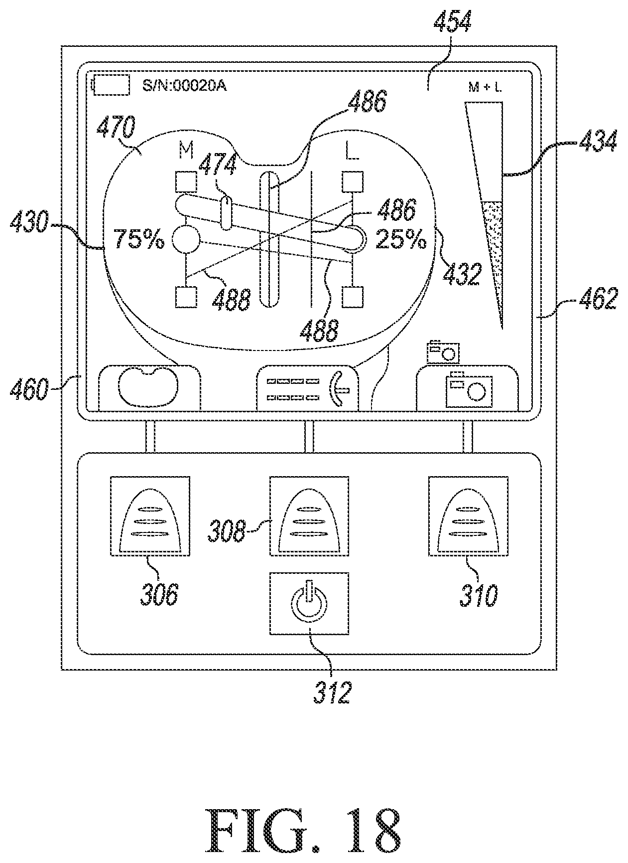 Patent US12324752 Figure 16 – Orthopaedic surgical system for determining joint forces of a patient's knee joint