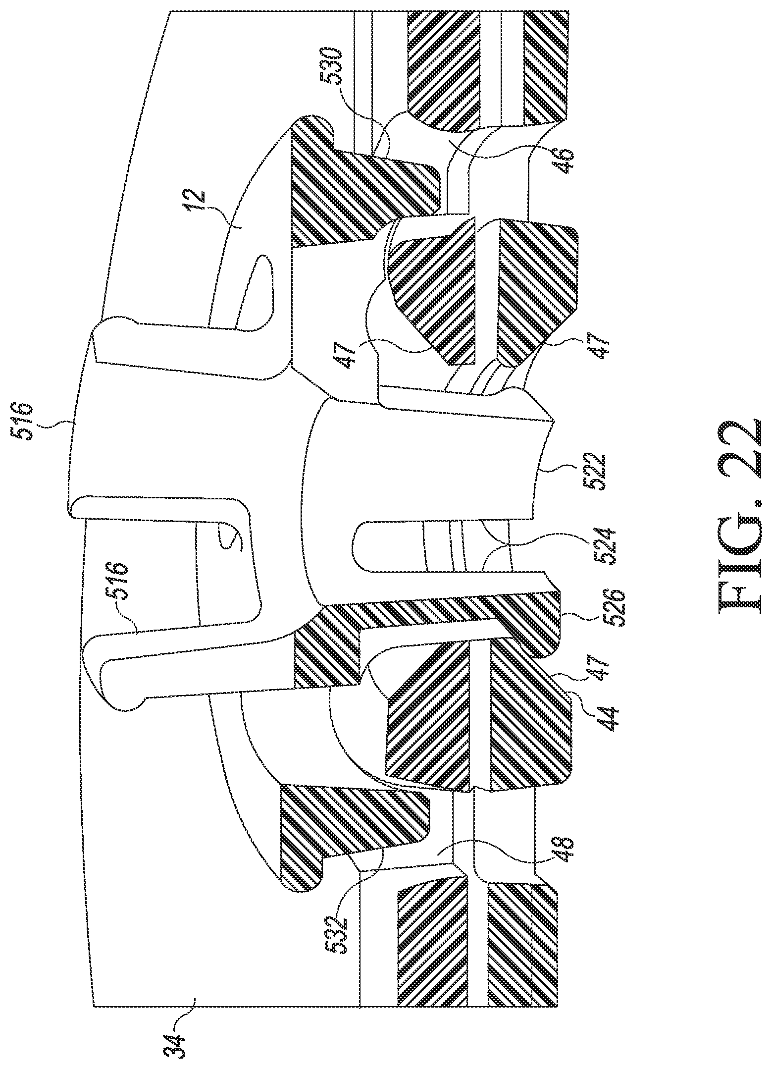 Patent US12324752 Figure 20 – Orthopaedic surgical system for determining joint forces of a patient's knee joint