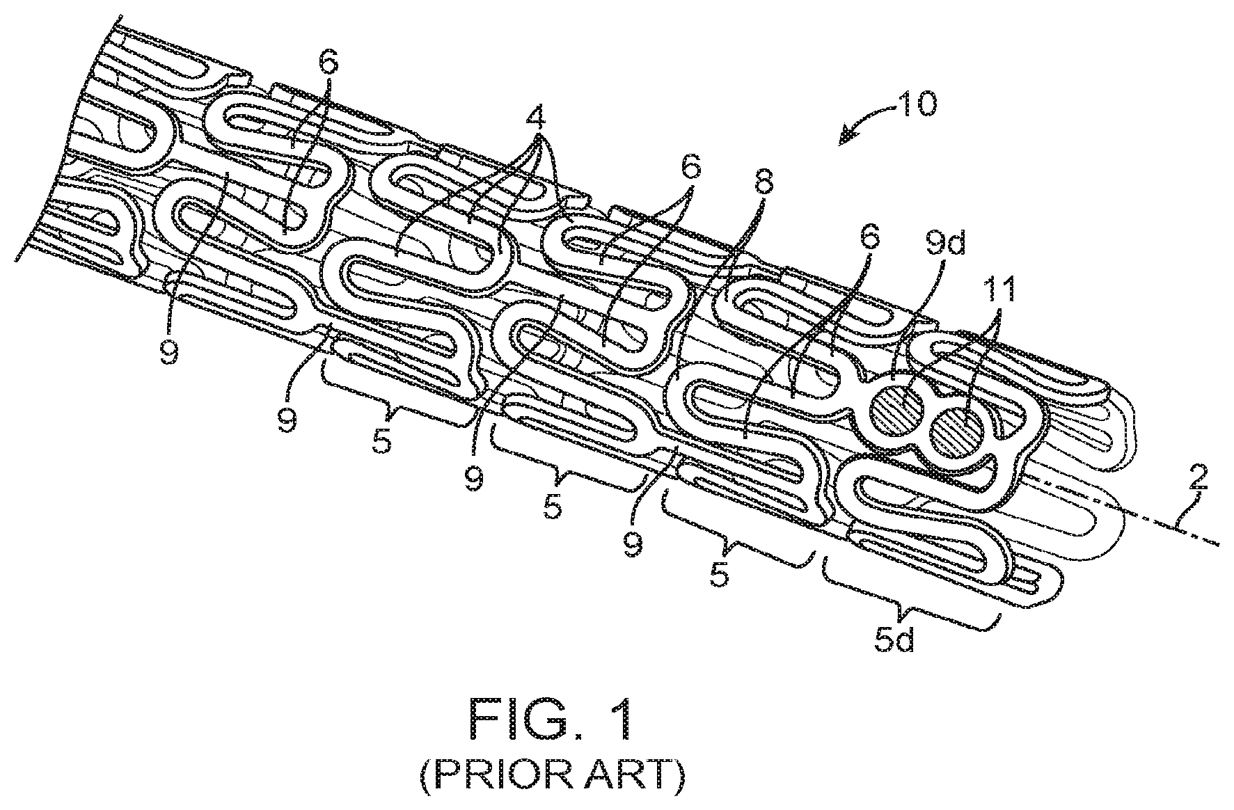 Patent US12324755 Figure 1 – Scaffolds having a radiopaque marker and methods for attaching a marker to a scaffold