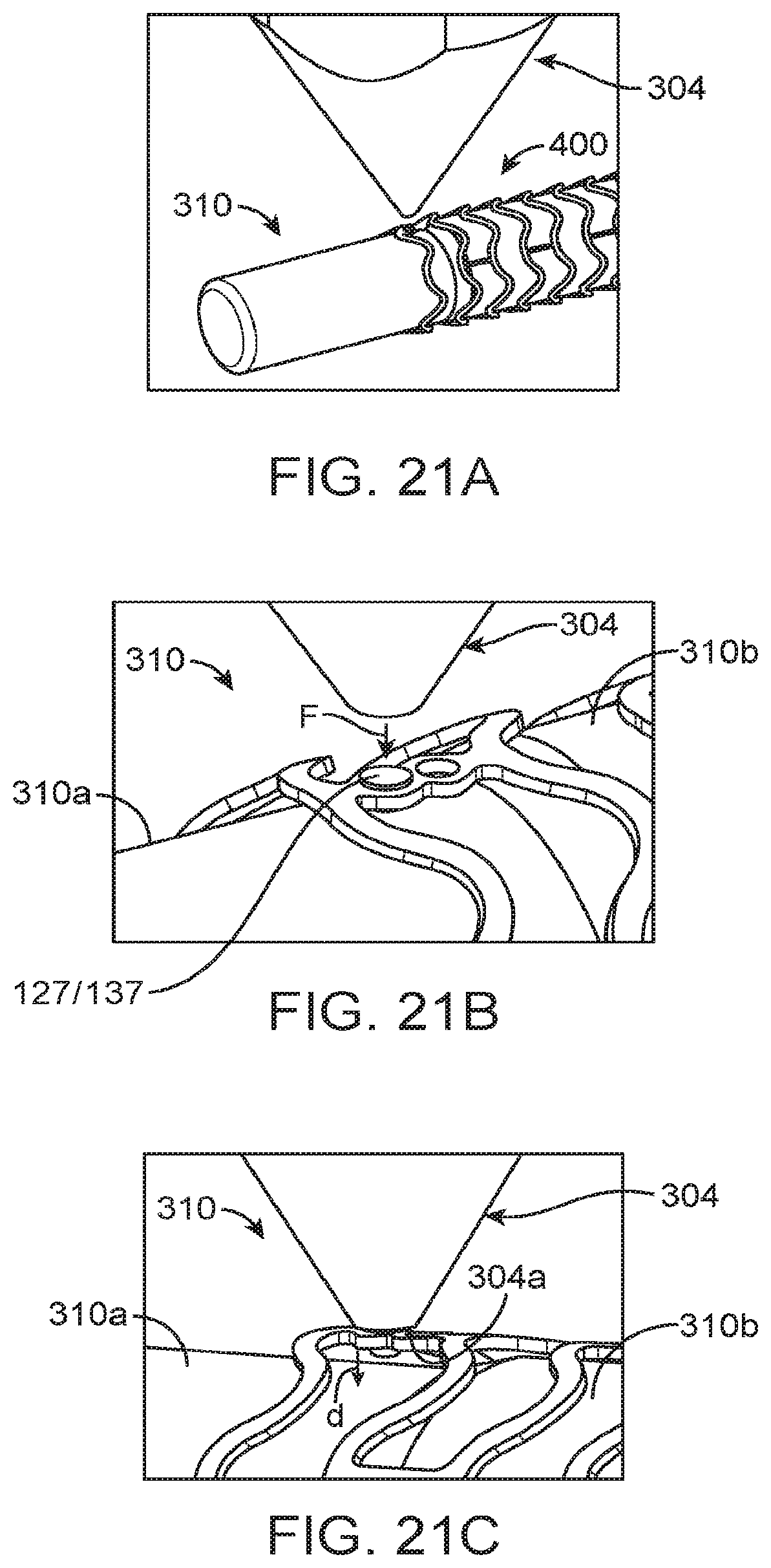 Patent US12324755 Figure 16 – Scaffolds having a radiopaque marker and methods for attaching a marker to a scaffold
