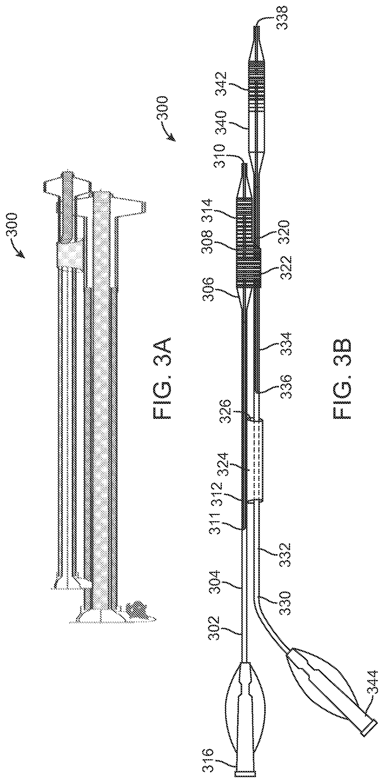 Patent US12324756 Figure 3 – System and methods for treating a bifurcation